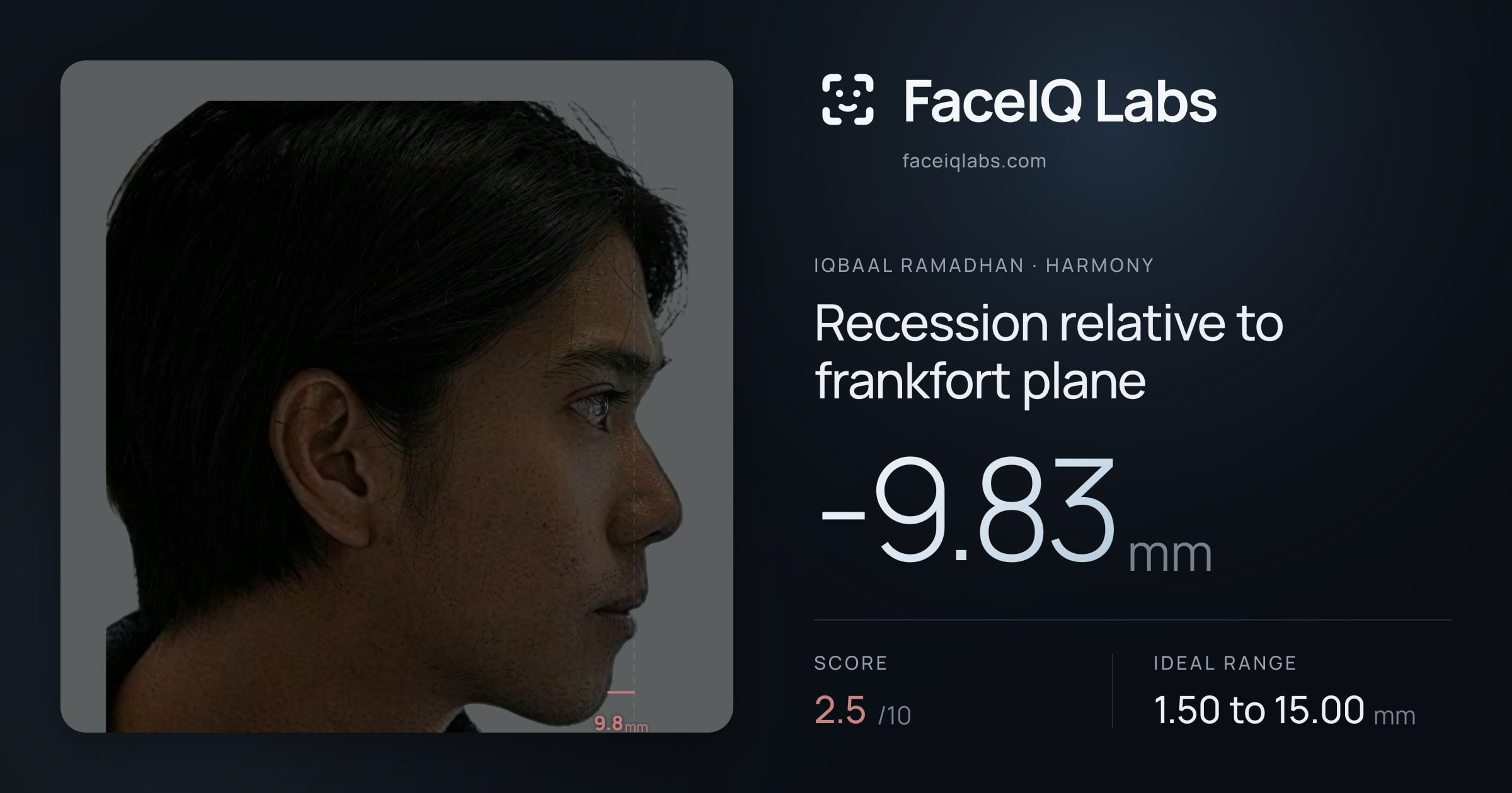 Iqbaal Ramadhan Recession relative to frankfort plane: -9.83mm, drawn on the photo