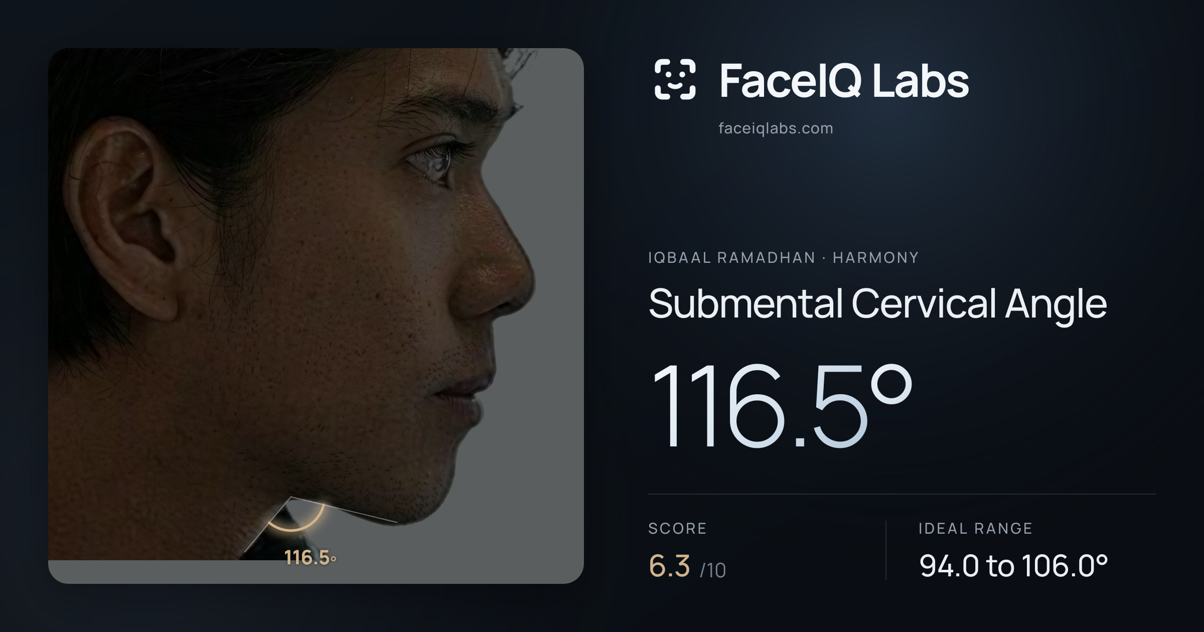 Iqbaal Ramadhan Submental Cervical Angle: 116.5°, drawn on the photo