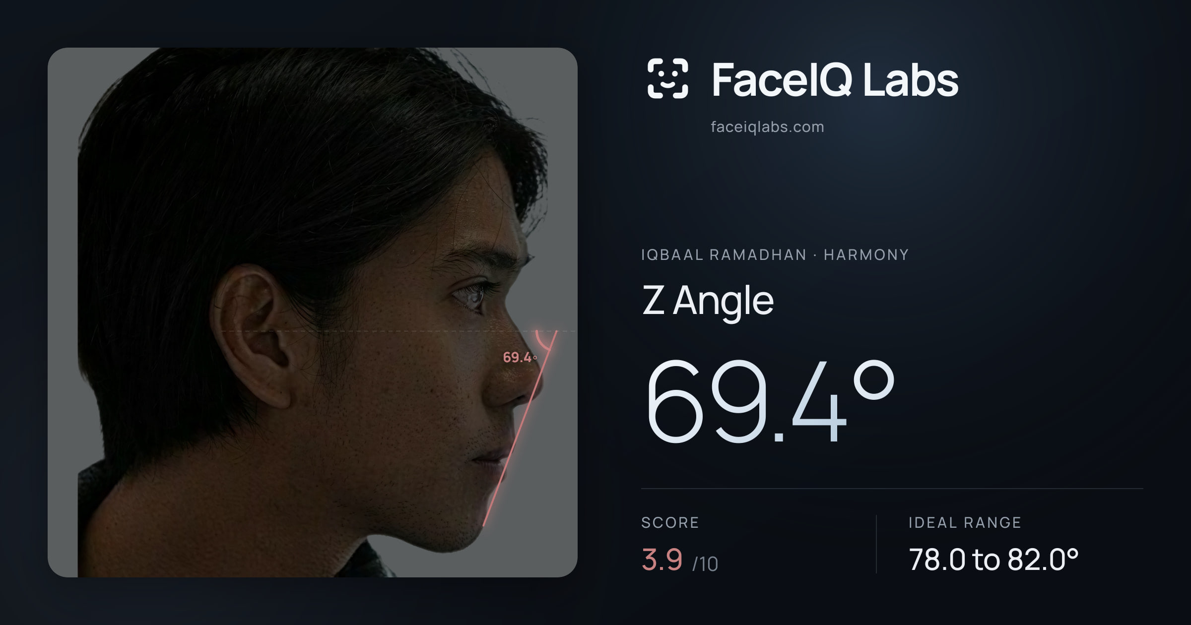Iqbaal Ramadhan Z Angle: 69.4°, drawn on the photo