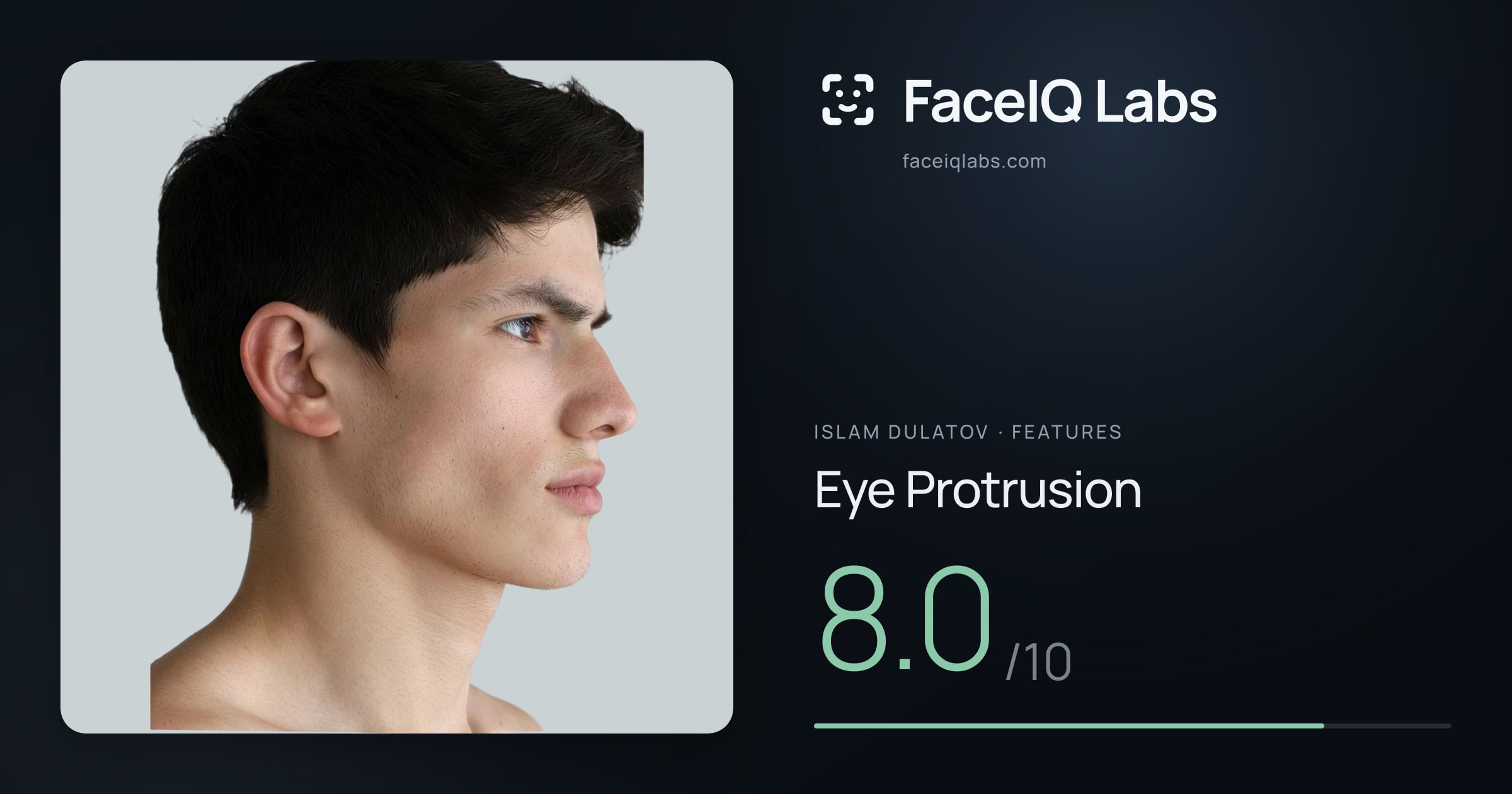 Islam Dulatov Eye Protrusion: 8.0/10, drawn on the photo