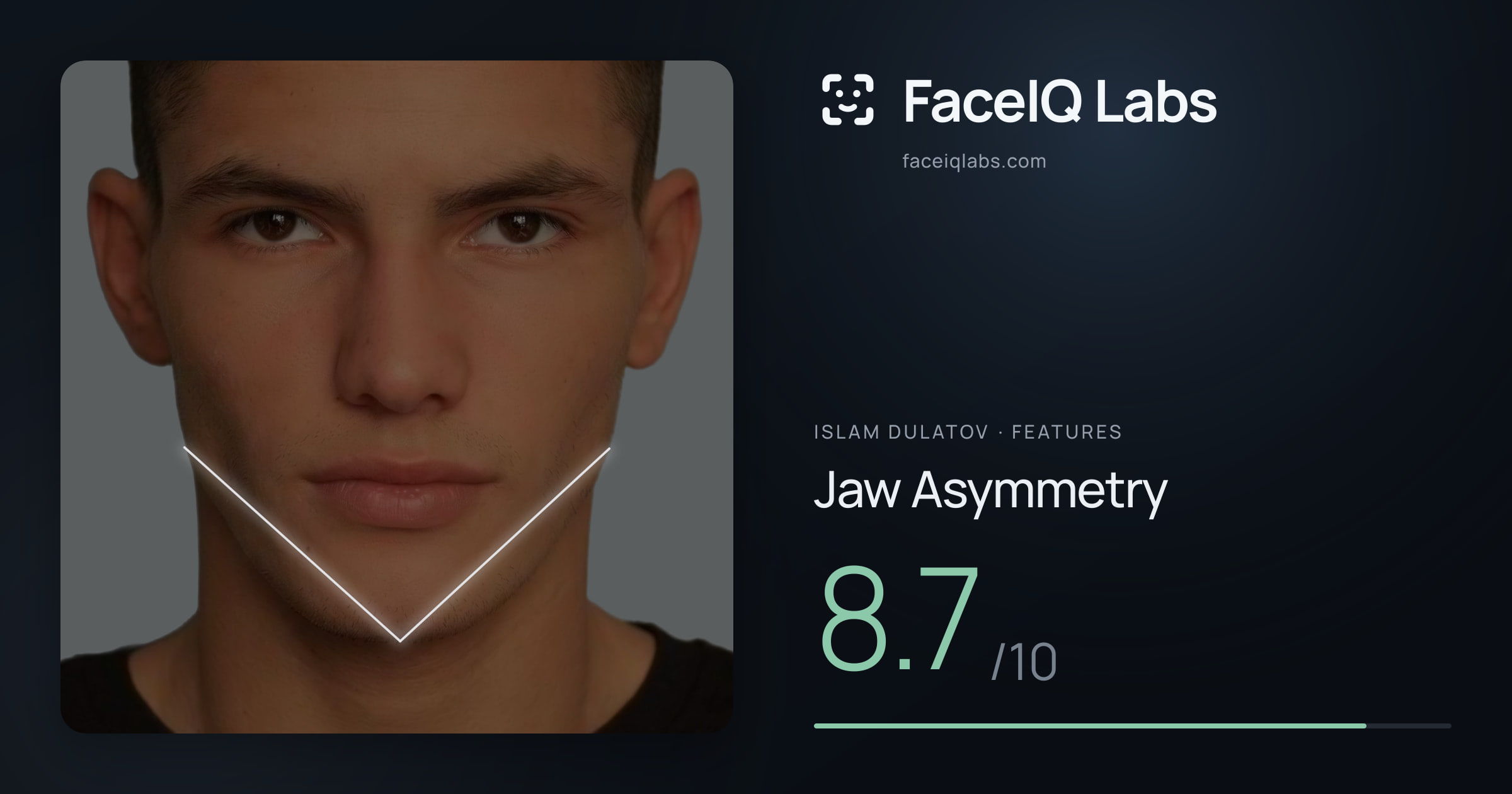 Islam Dulatov Jaw Asymmetry: 8.7/10, drawn on the photo