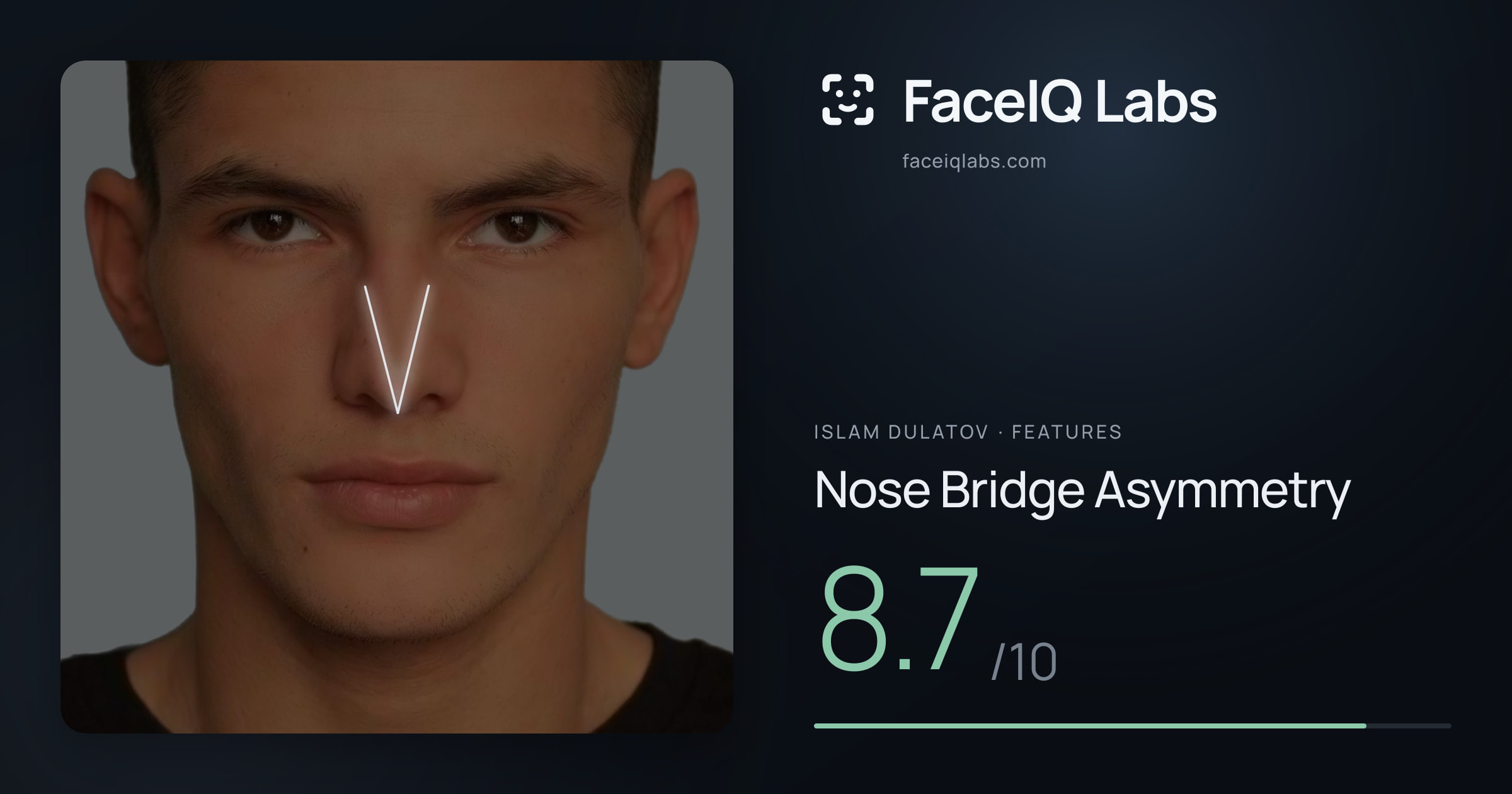 Islam Dulatov Nose Bridge Asymmetry: 8.7/10, drawn on the photo