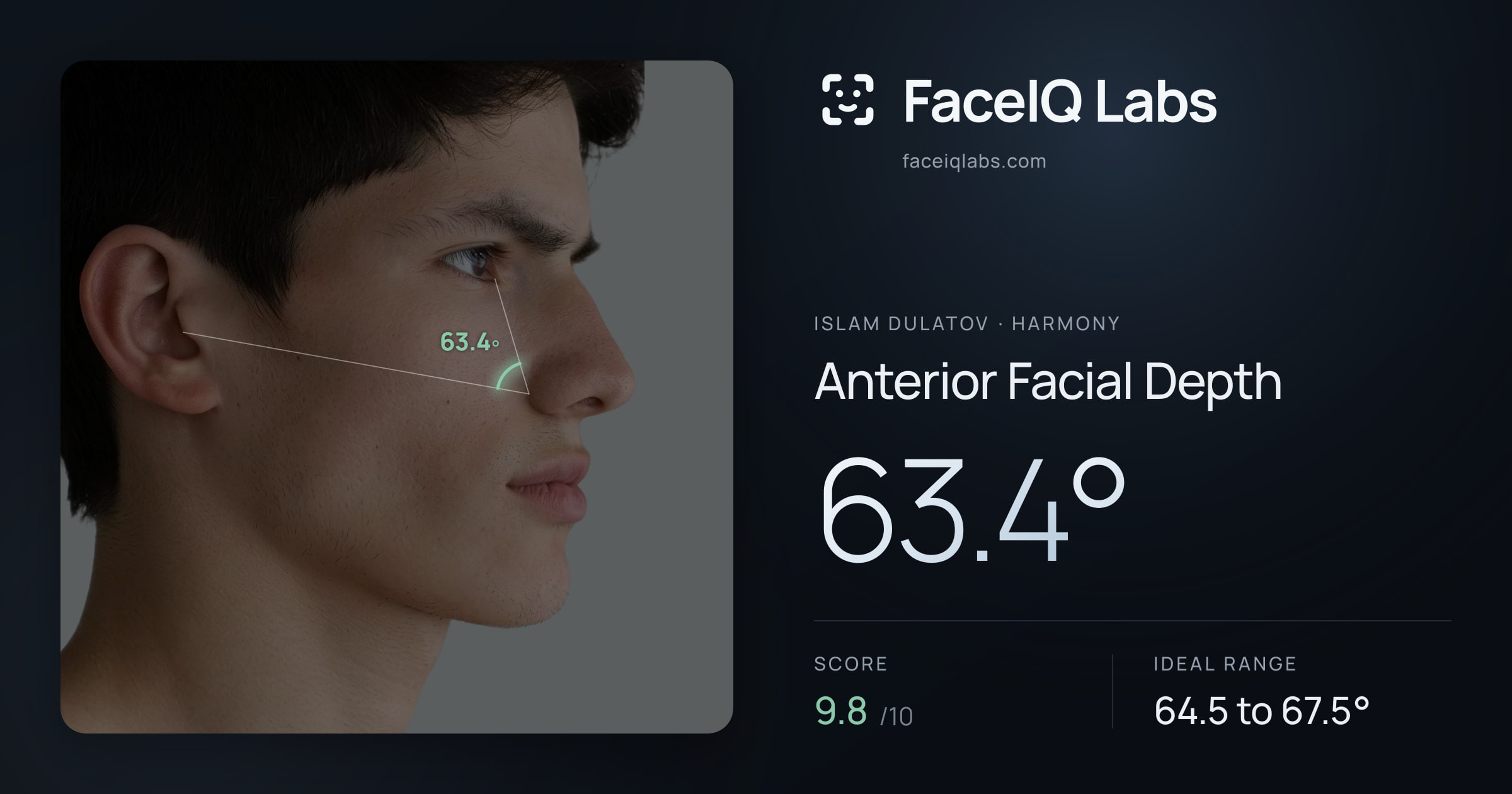 Islam Dulatov Anterior Facial Depth: 63.4°, drawn on the photo