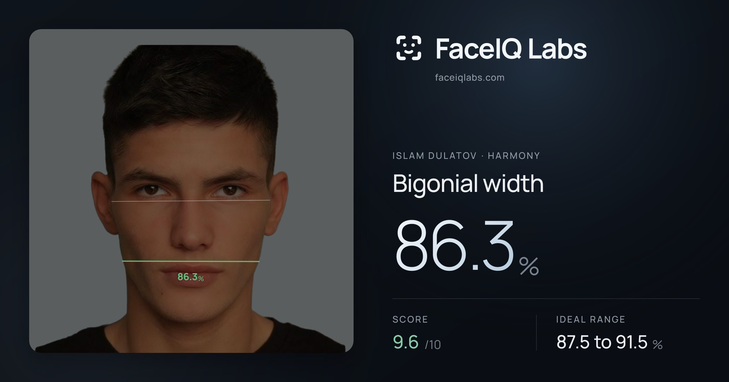 Islam Dulatov Bigonial width: 86.3%, drawn on the photo