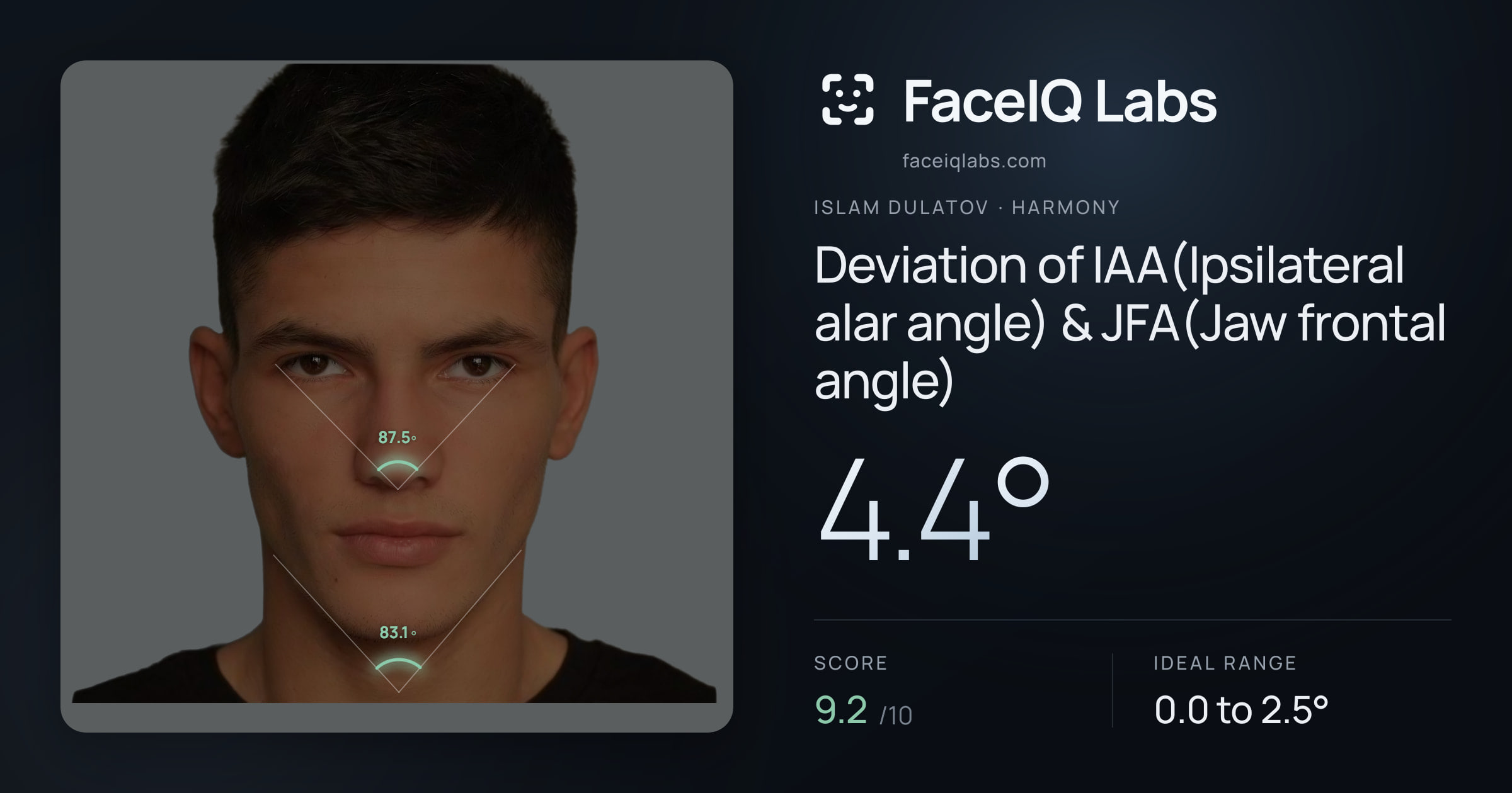 Islam Dulatov Deviation of IAA(Ipsilateral alar angle) & JFA(Jaw frontal angle): 4.4°, drawn on the photo