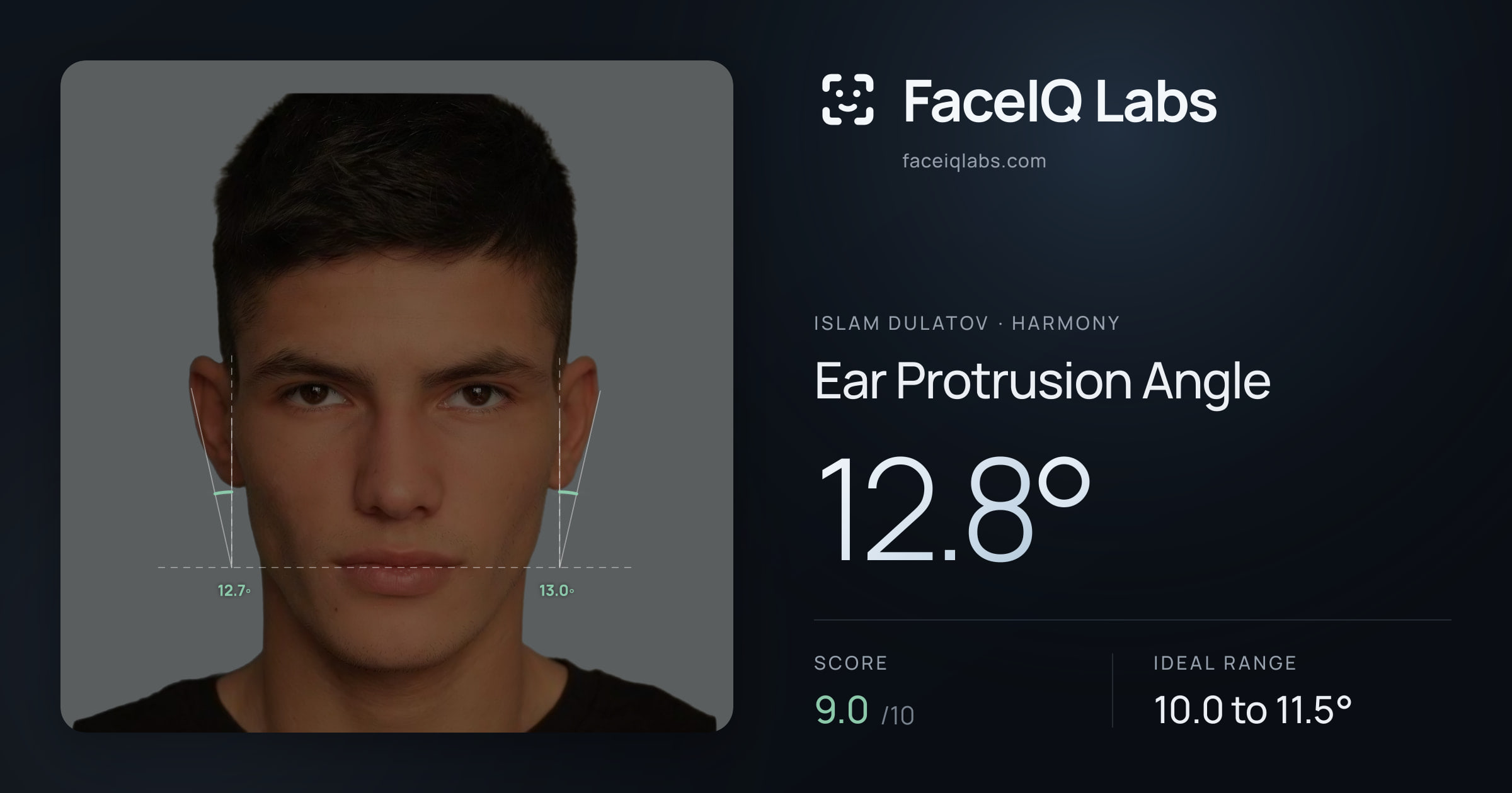 Islam Dulatov Ear Protrusion Angle: 12.8°, drawn on the photo