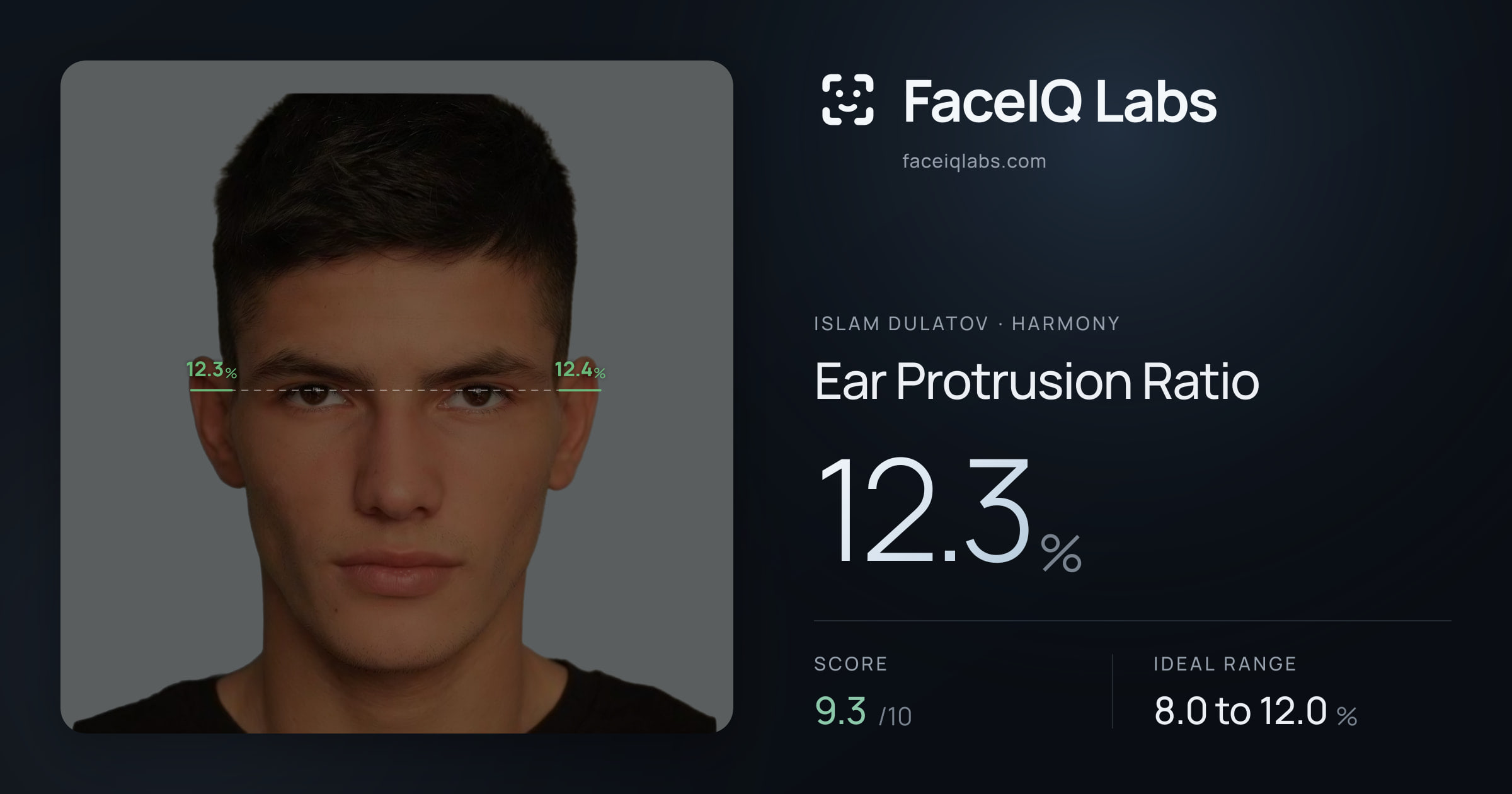 Islam Dulatov Ear Protrusion Ratio: 12.3%, drawn on the photo