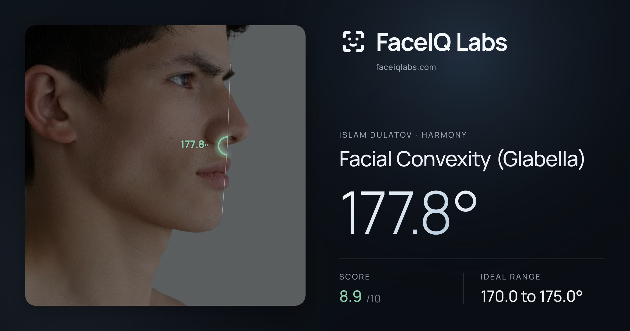 Islam Dulatov Facial Convexity (Glabella): 177.8°, drawn on the photo