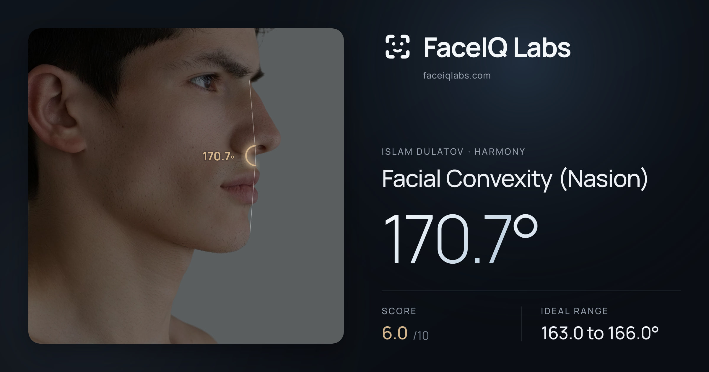 Islam Dulatov Facial Convexity (Nasion): 170.7°, drawn on the photo