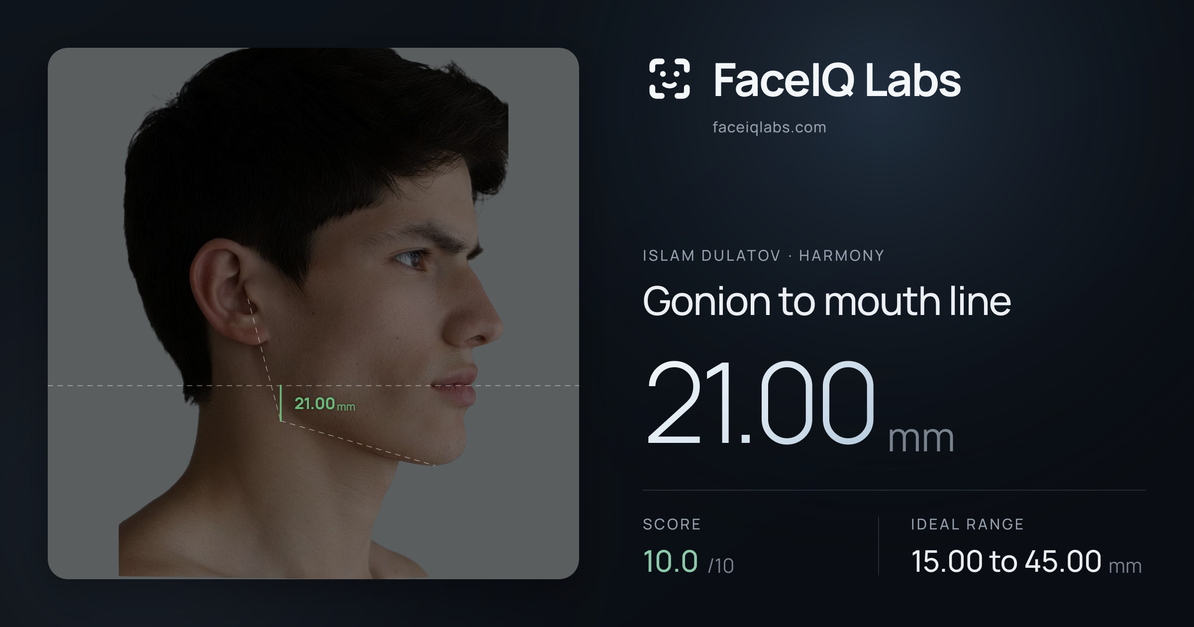 Islam Dulatov Gonion to mouth line: 21.00mm, drawn on the photo