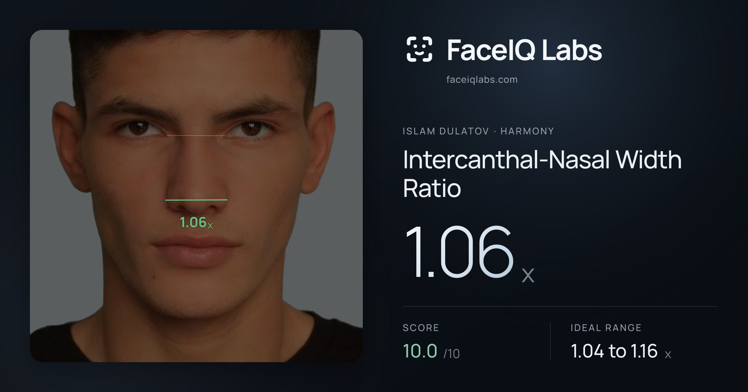 Islam Dulatov Intercanthal-Nasal Width Ratio: 1.06x, drawn on the photo