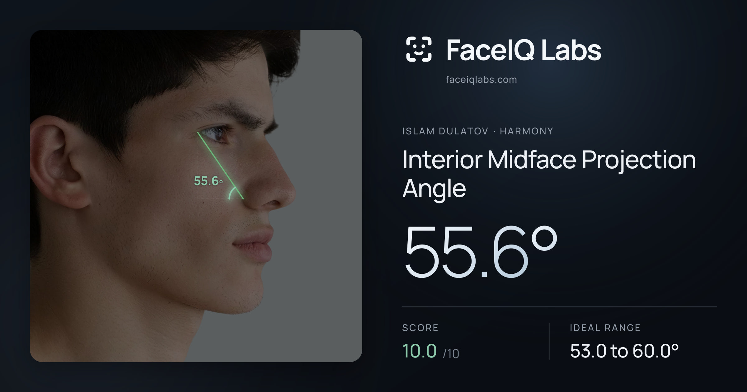Islam Dulatov Interior Midface Projection Angle: 55.6°, drawn on the photo