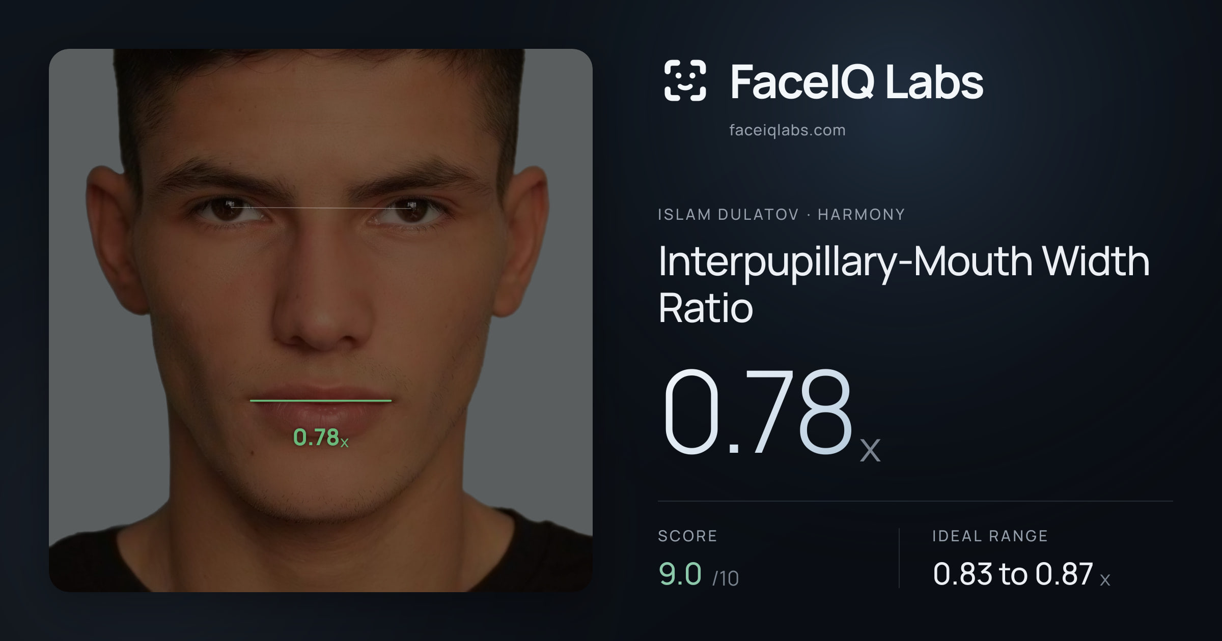Islam Dulatov Interpupillary-Mouth Width Ratio: 0.78x, drawn on the photo