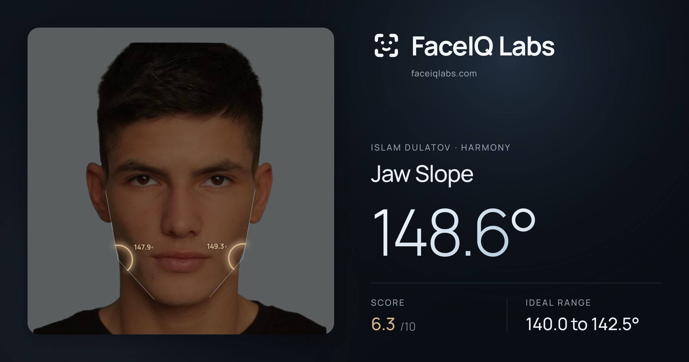 Islam Dulatov Jaw Slope: 148.6°, drawn on the photo