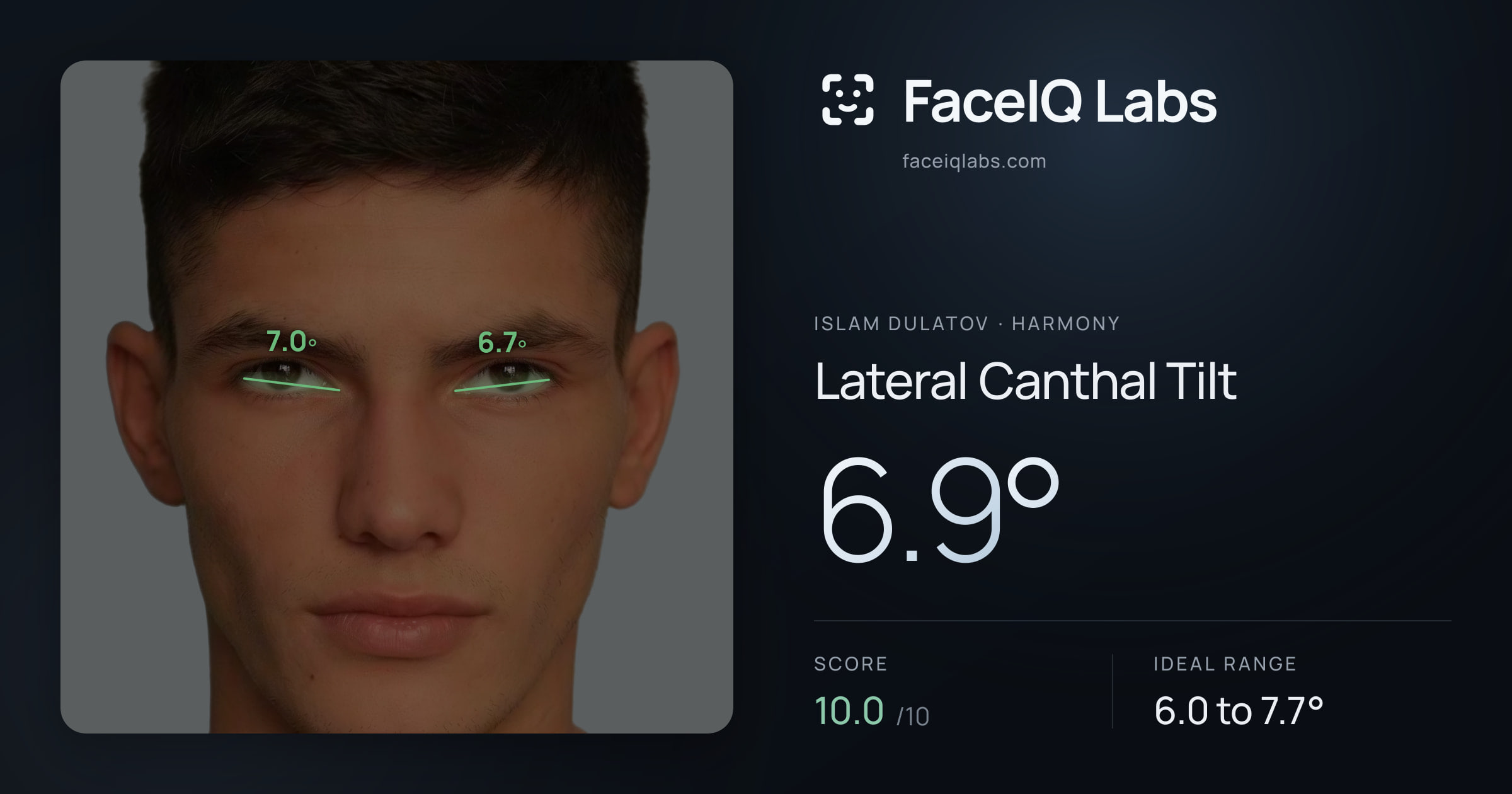 Islam Dulatov Lateral Canthal Tilt: 6.9°, drawn on the photo
