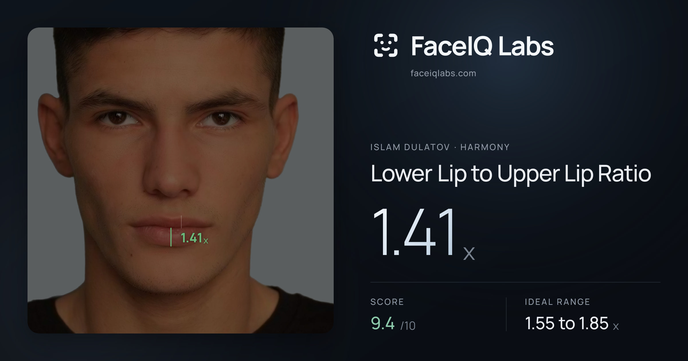 Islam Dulatov Lower Lip to Upper Lip Ratio: 1.41x, drawn on the photo