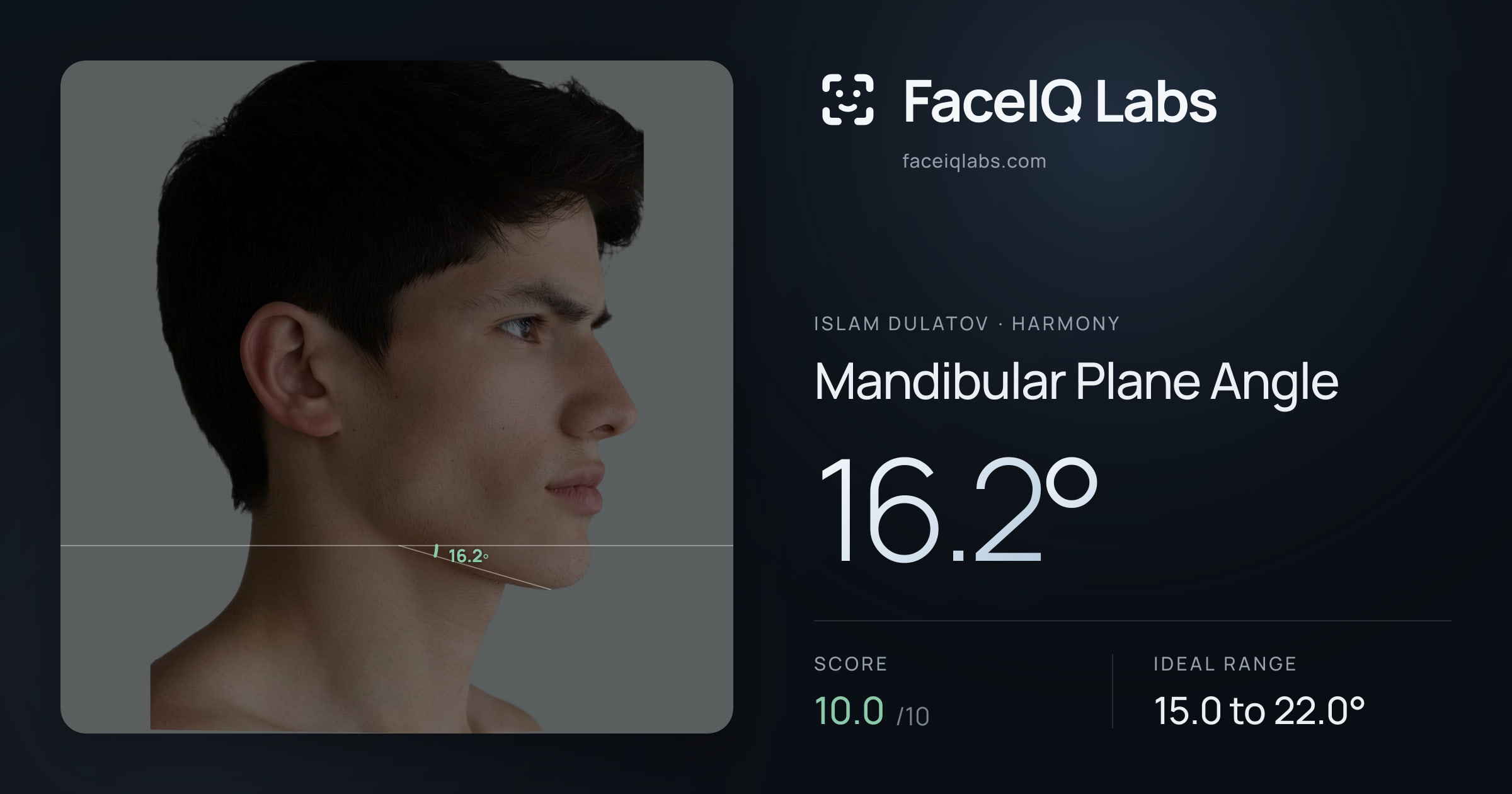 Islam Dulatov Mandibular Plane Angle: 16.2°, drawn on the photo