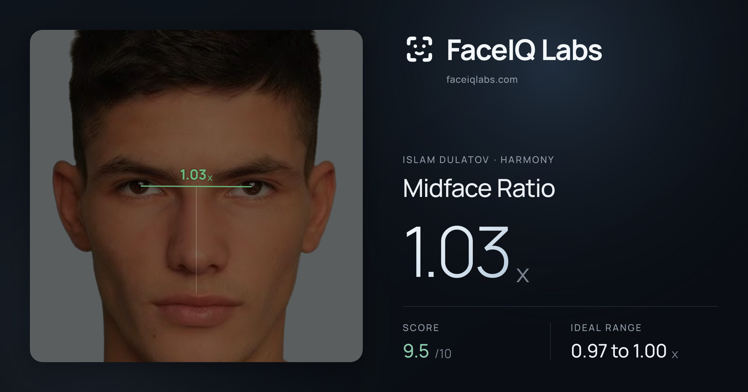 Islam Dulatov Midface Ratio: 1.03x, drawn on the photo
