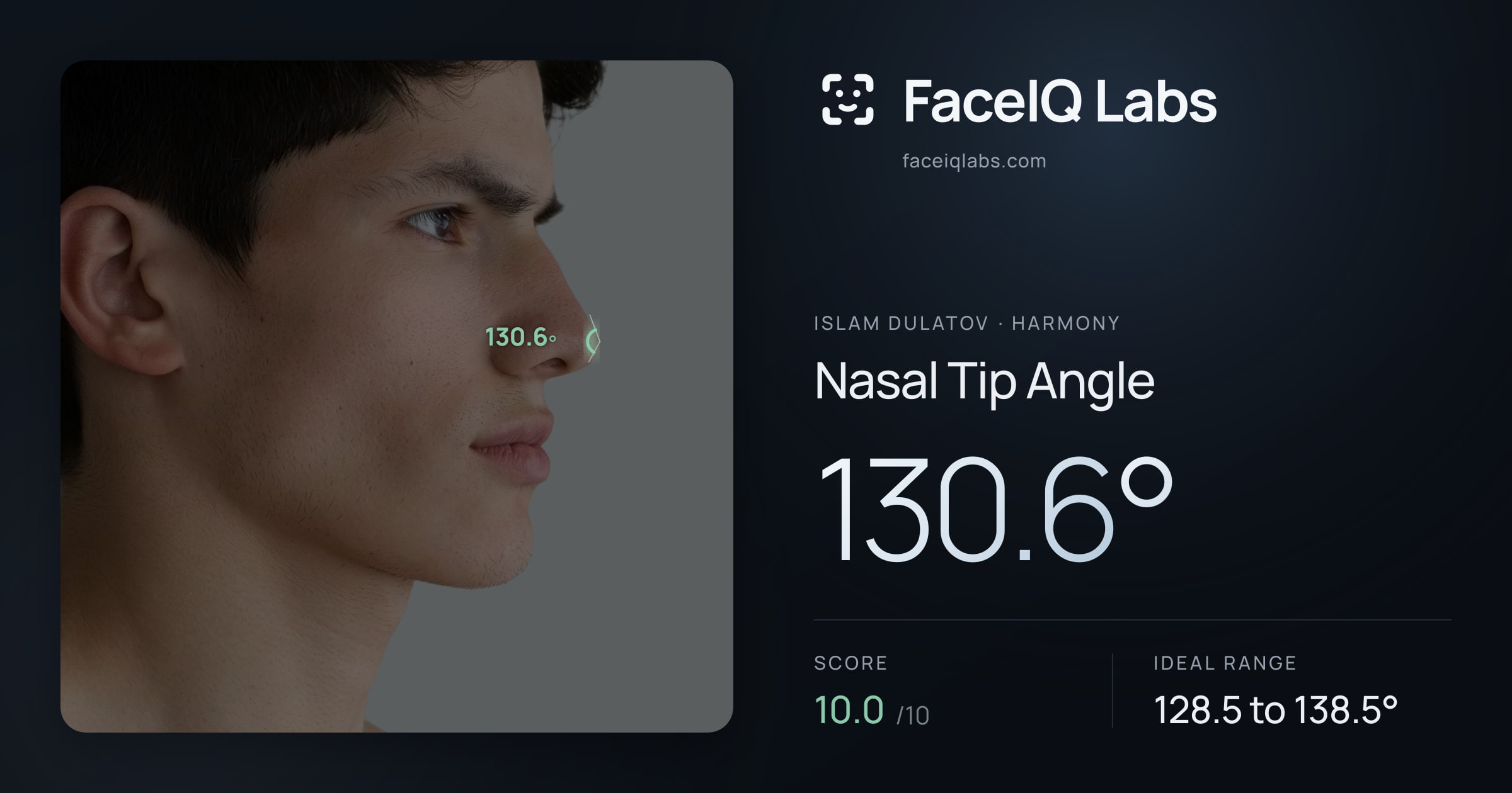 Islam Dulatov Nasal Tip Angle: 130.6°, drawn on the photo