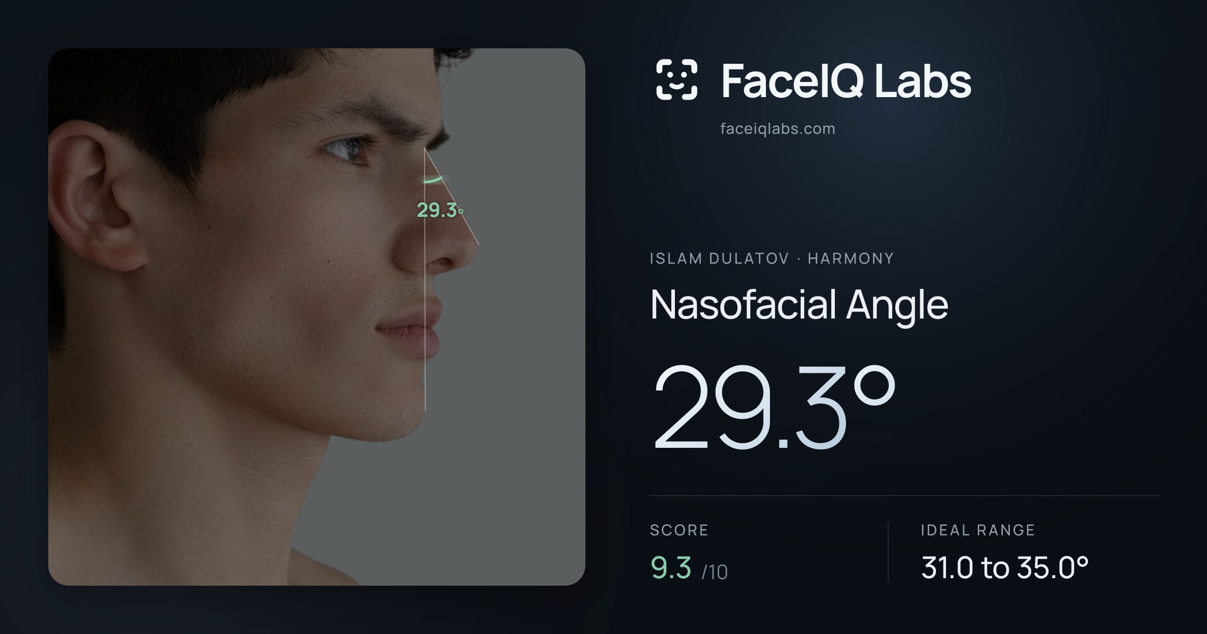 Islam Dulatov Nasofacial Angle: 29.3°, drawn on the photo