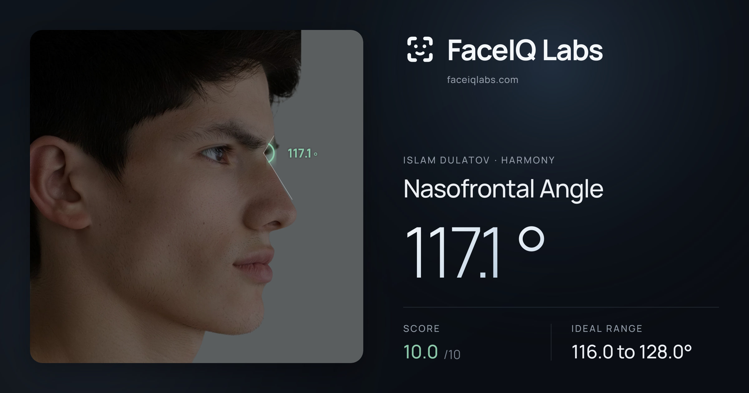 Islam Dulatov Nasofrontal Angle: 117.1°, drawn on the photo