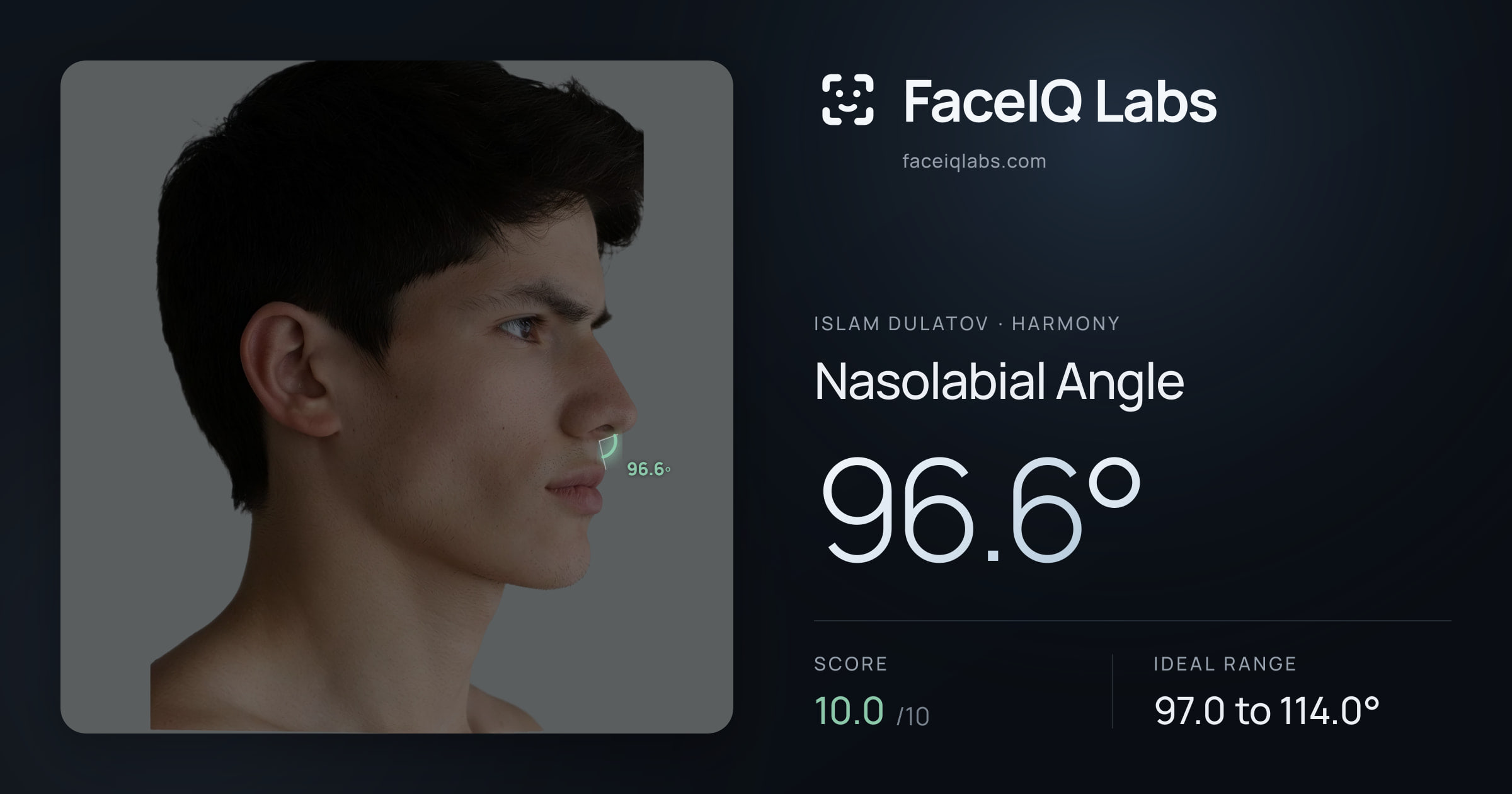 Islam Dulatov Nasolabial Angle: 96.6°, drawn on the photo