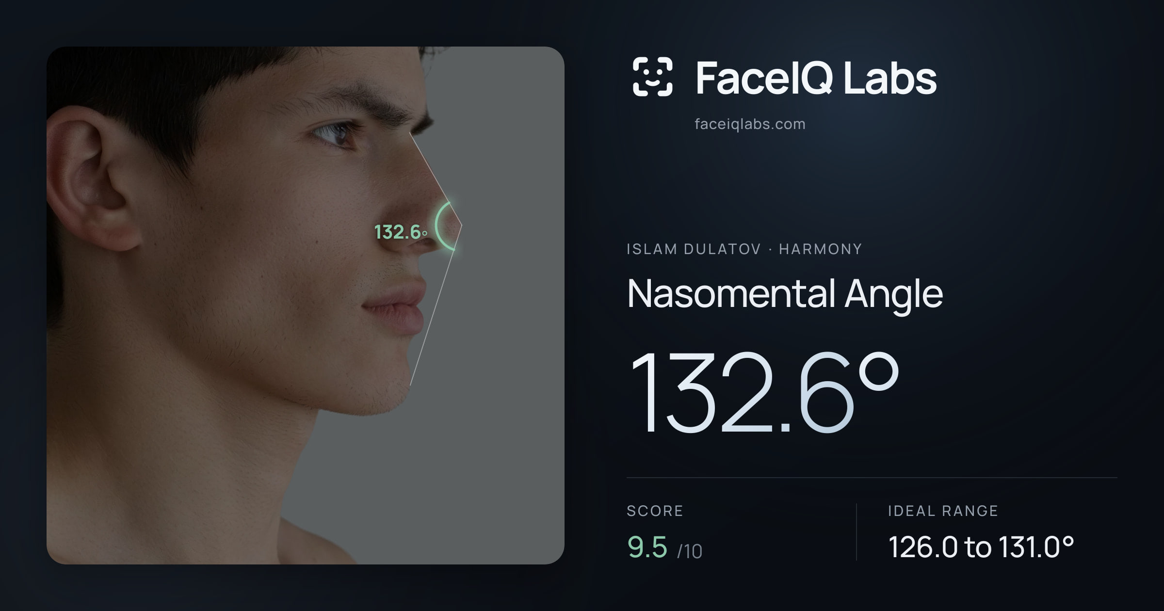 Islam Dulatov Nasomental Angle: 132.6°, drawn on the photo