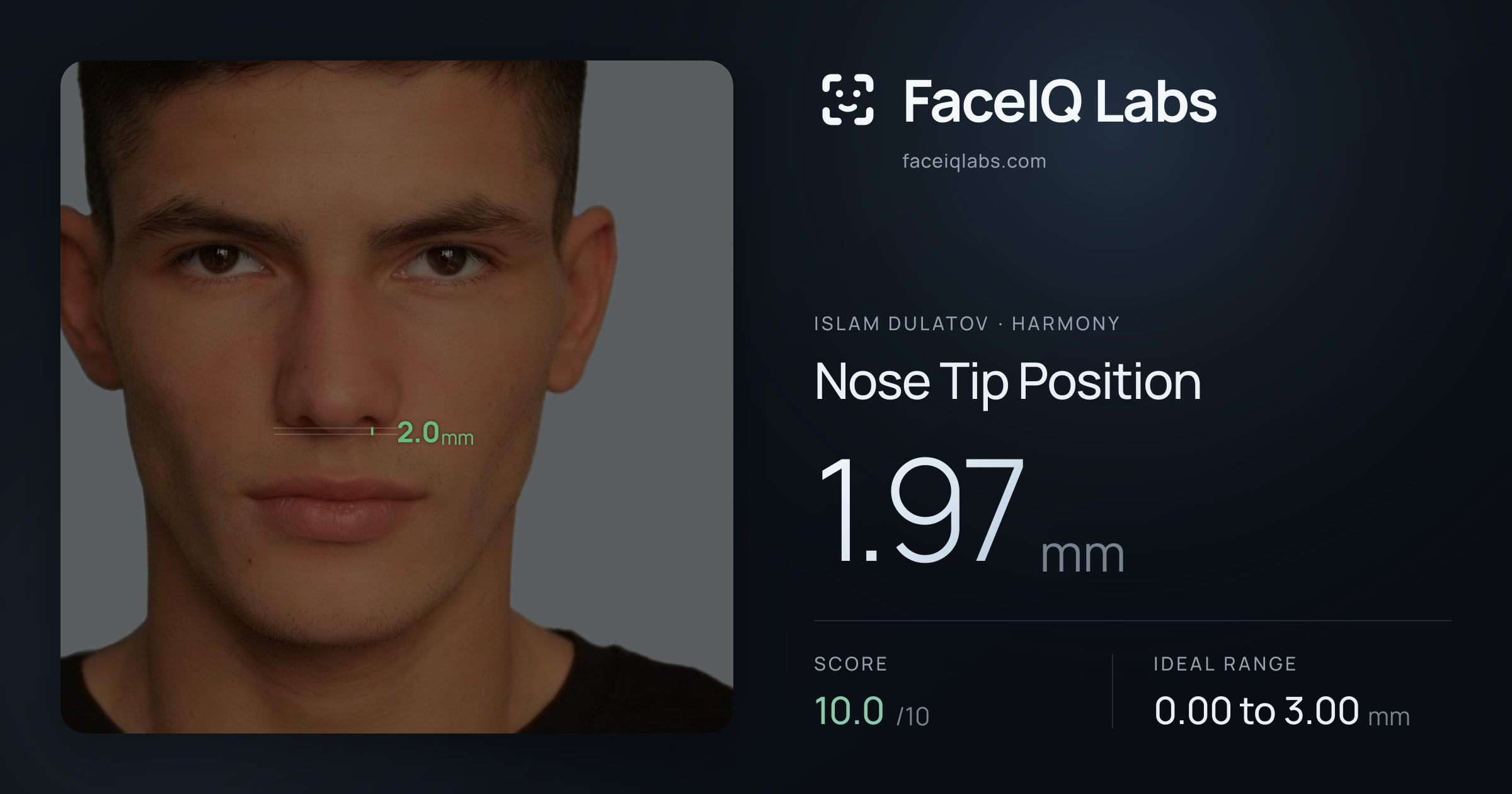 Islam Dulatov Nose Tip Position: 1.97mm, drawn on the photo