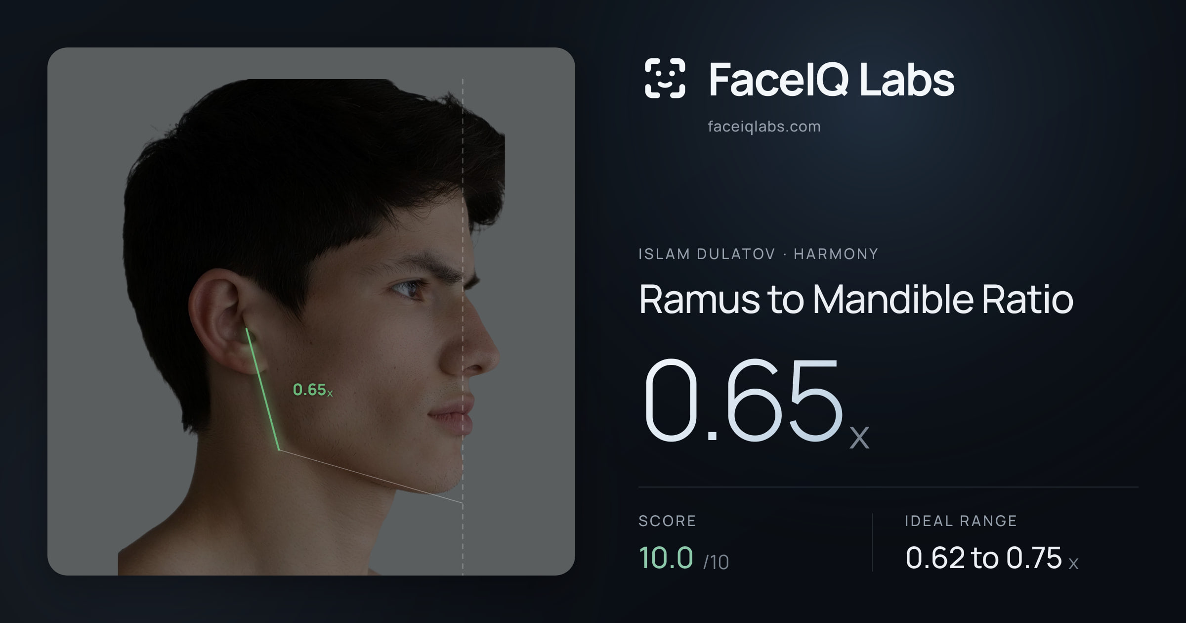 Islam Dulatov Ramus to Mandible Ratio: 0.65x, drawn on the photo