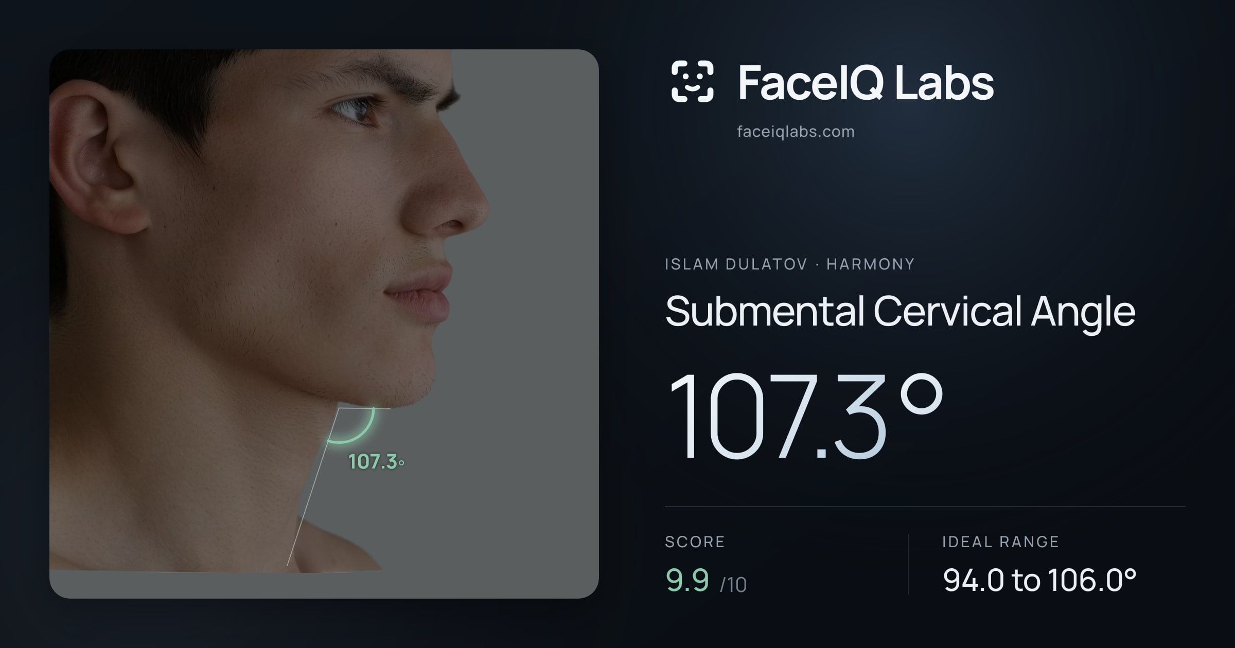 Islam Dulatov Submental Cervical Angle: 107.3°, drawn on the photo