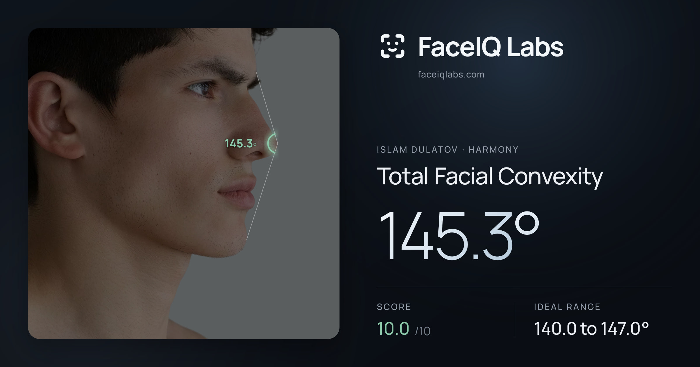 Islam Dulatov Total Facial Convexity: 145.3°, drawn on the photo