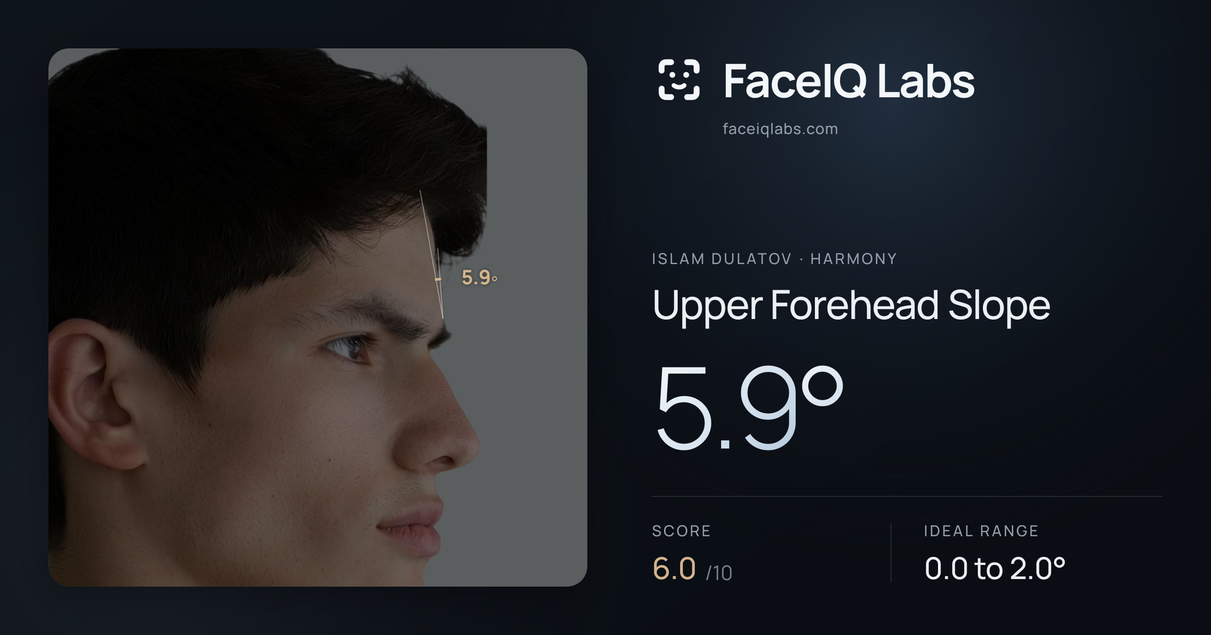 Islam Dulatov Upper Forehead Slope: 5.9°, drawn on the photo
