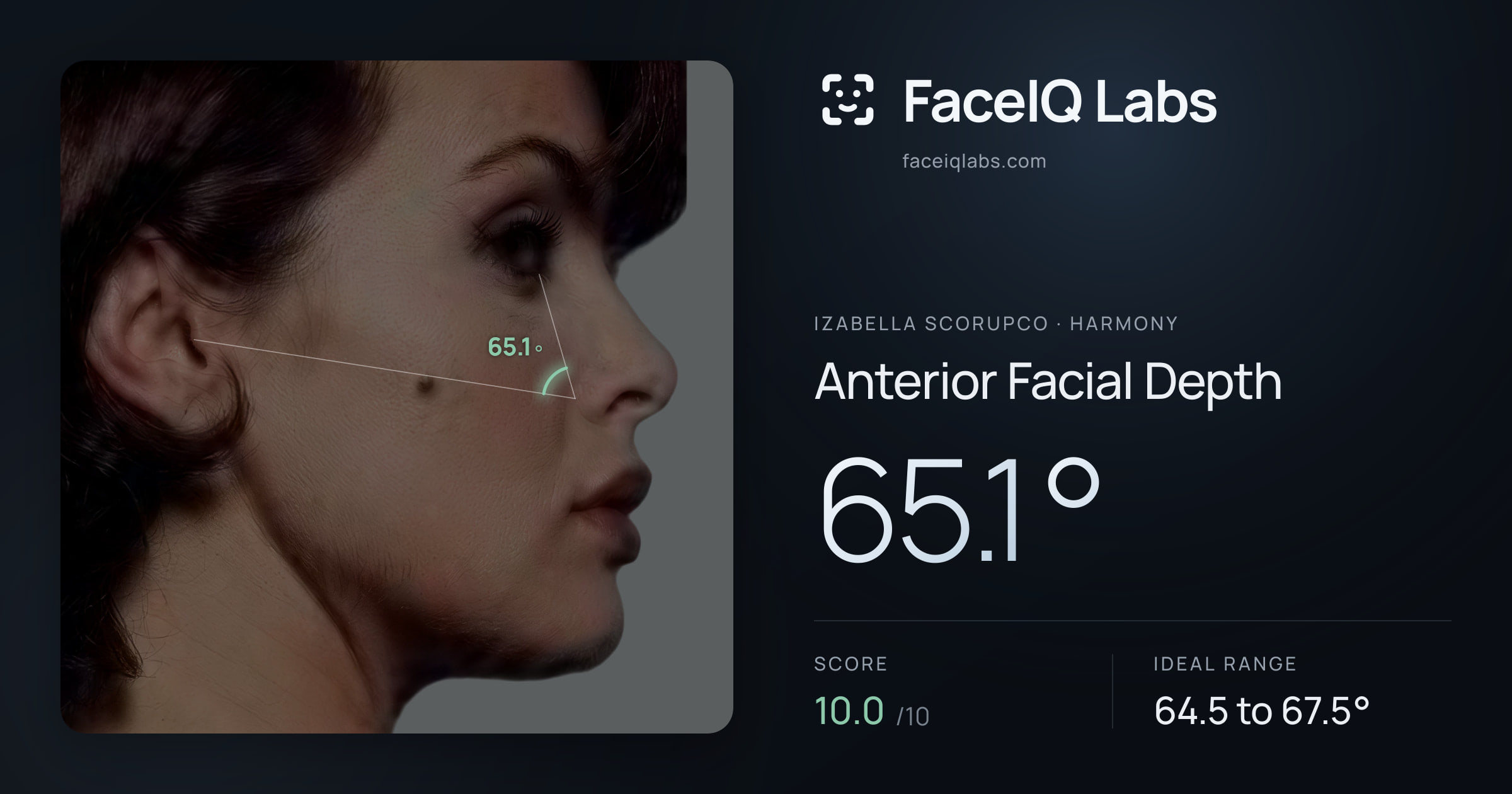 Izabella Scorupco Anterior Facial Depth: 65.1°, drawn on the photo