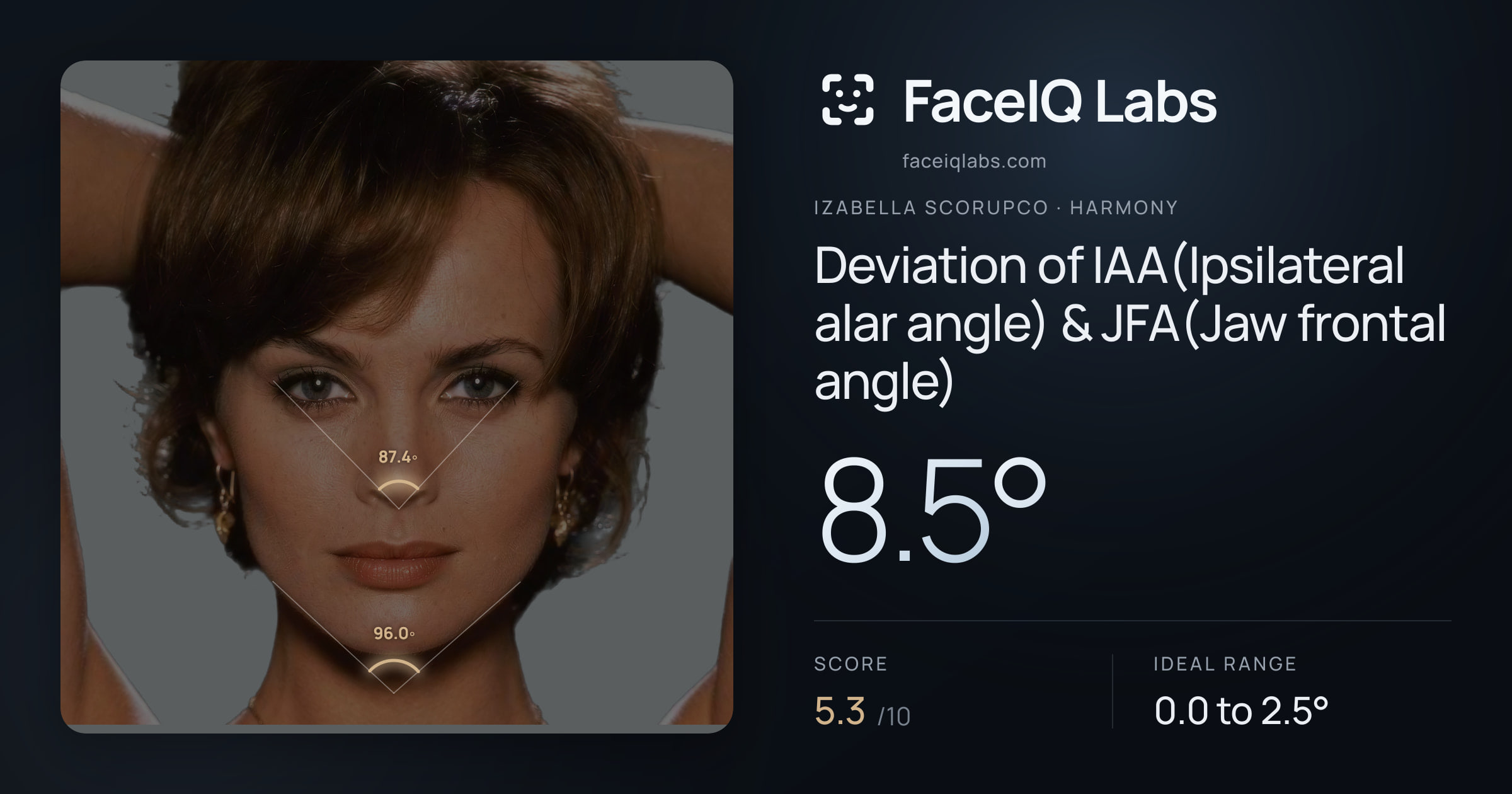 Izabella Scorupco Deviation of IAA(Ipsilateral alar angle) & JFA(Jaw frontal angle): 8.5°, drawn on the photo
