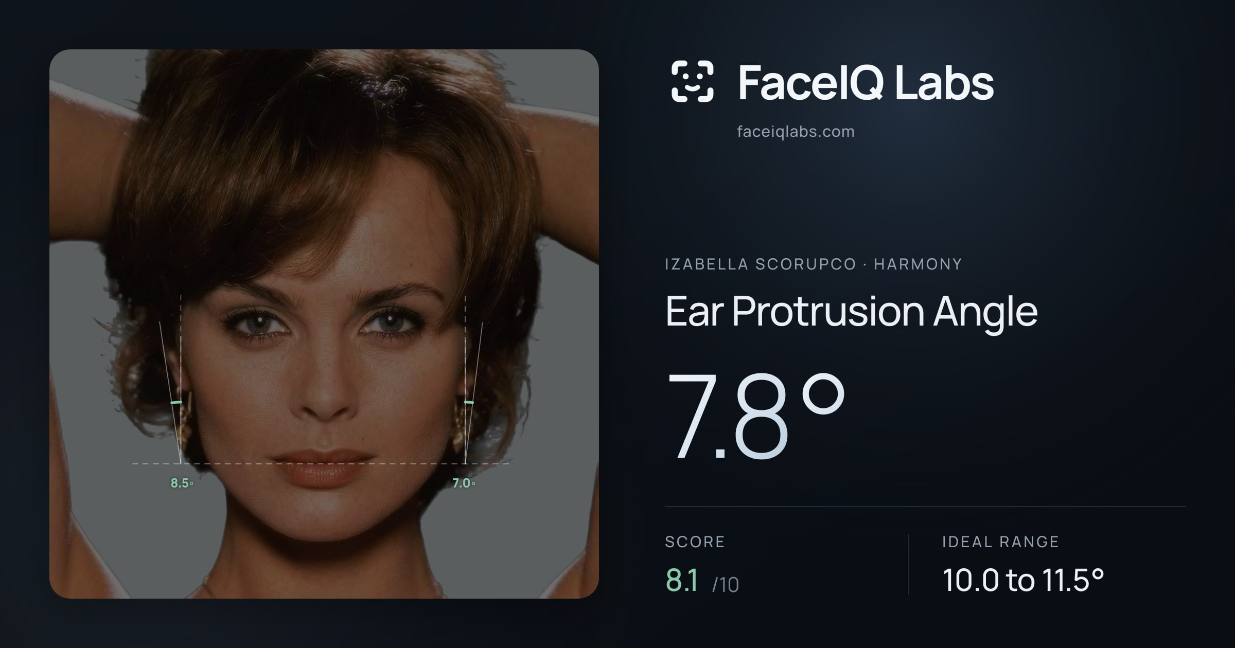Izabella Scorupco Ear Protrusion Angle: 7.8°, drawn on the photo