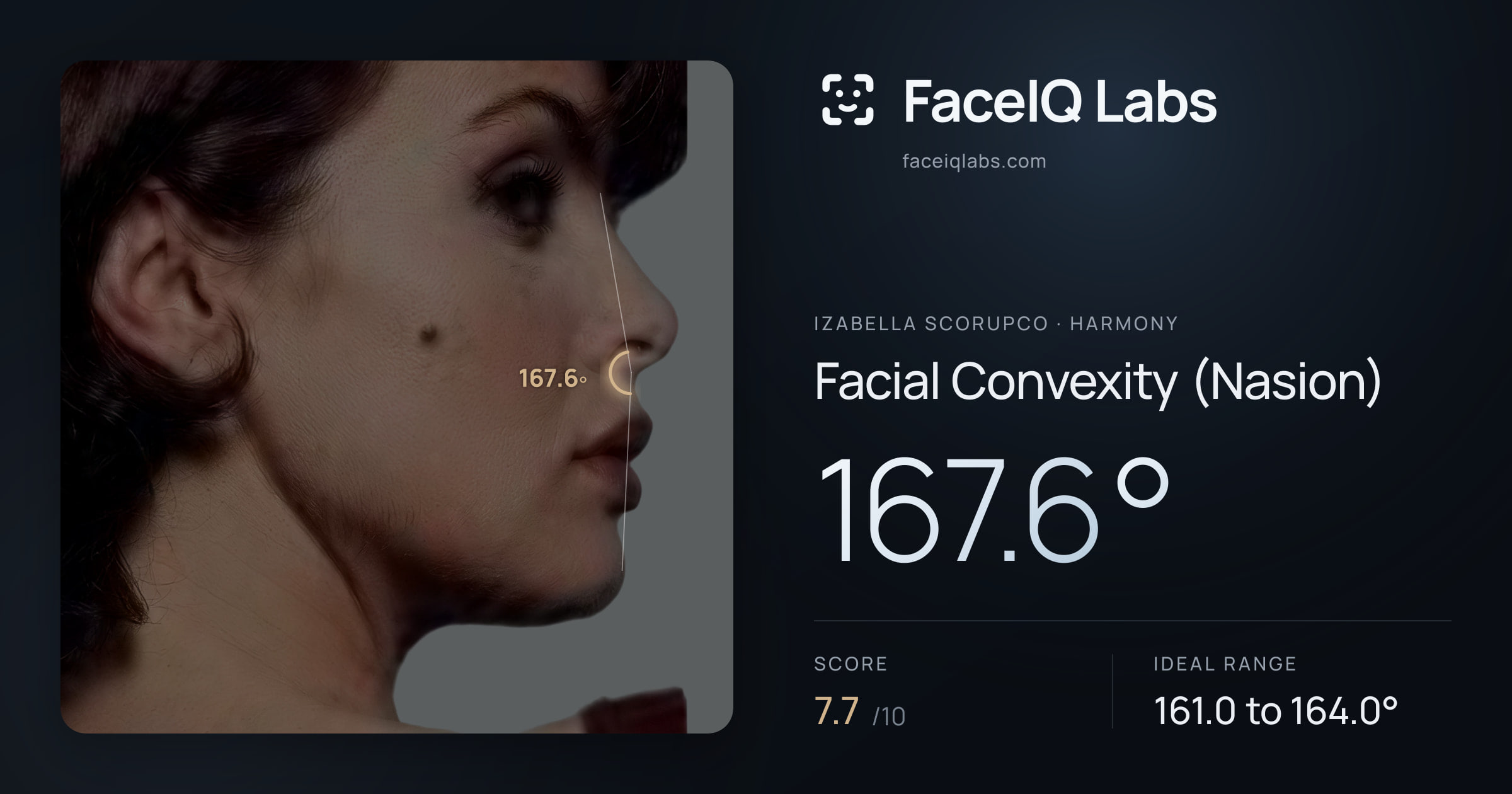 Izabella Scorupco Facial Convexity (Nasion): 167.6°, drawn on the photo