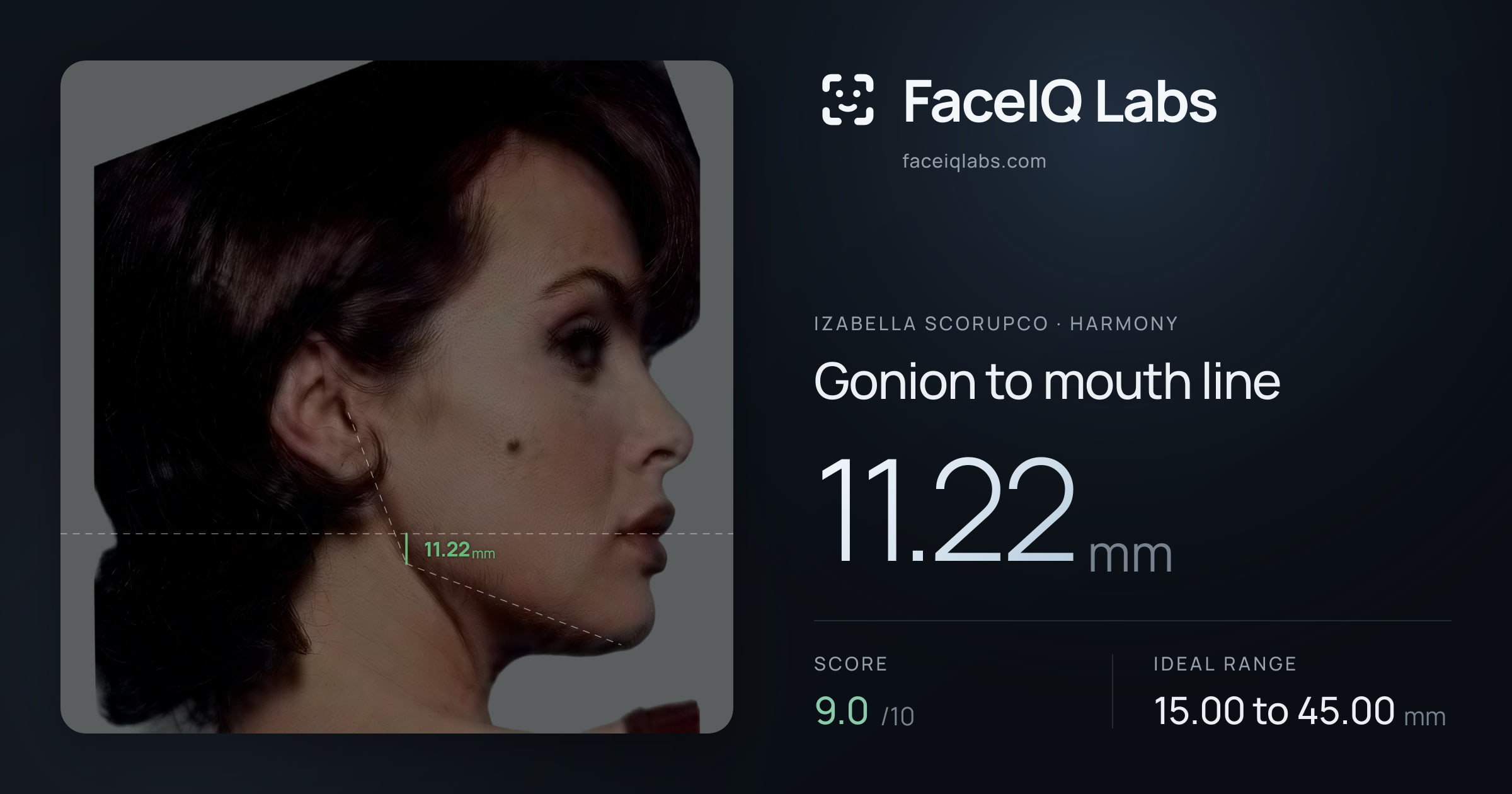 Izabella Scorupco Gonion to mouth line: 11.22mm, drawn on the photo