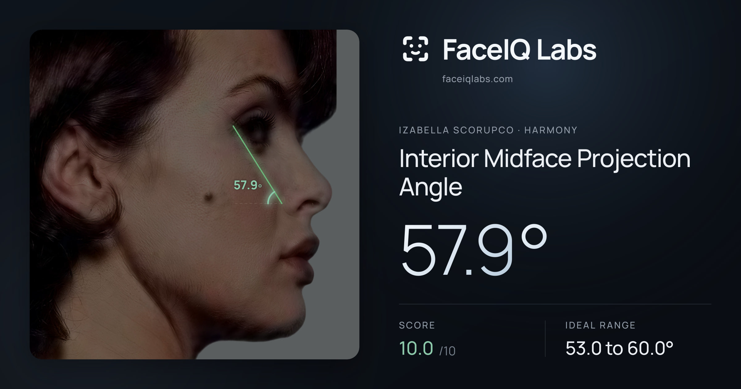 Izabella Scorupco Interior Midface Projection Angle: 57.9°, drawn on the photo
