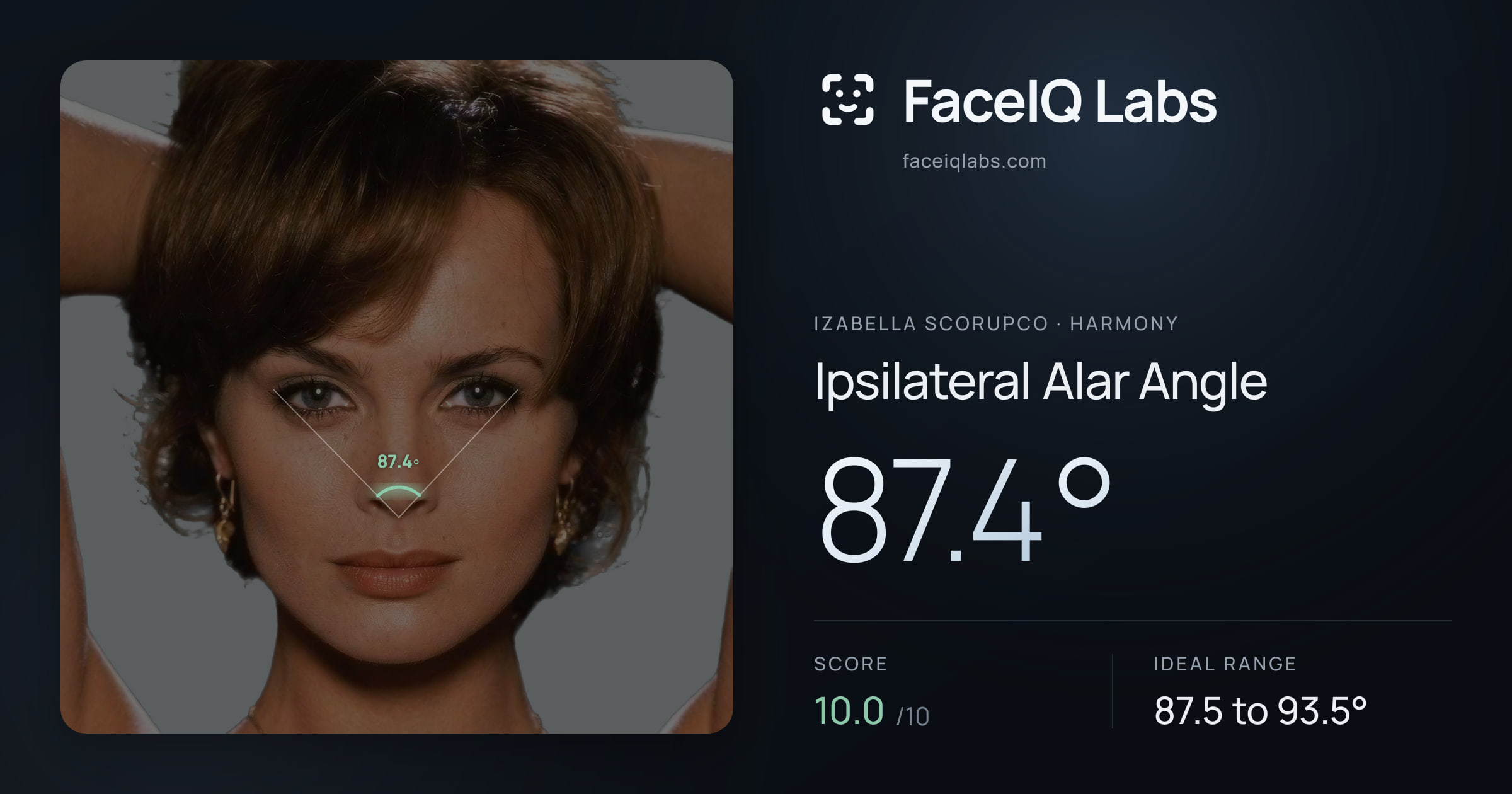 Izabella Scorupco Ipsilateral Alar Angle: 87.4°, drawn on the photo