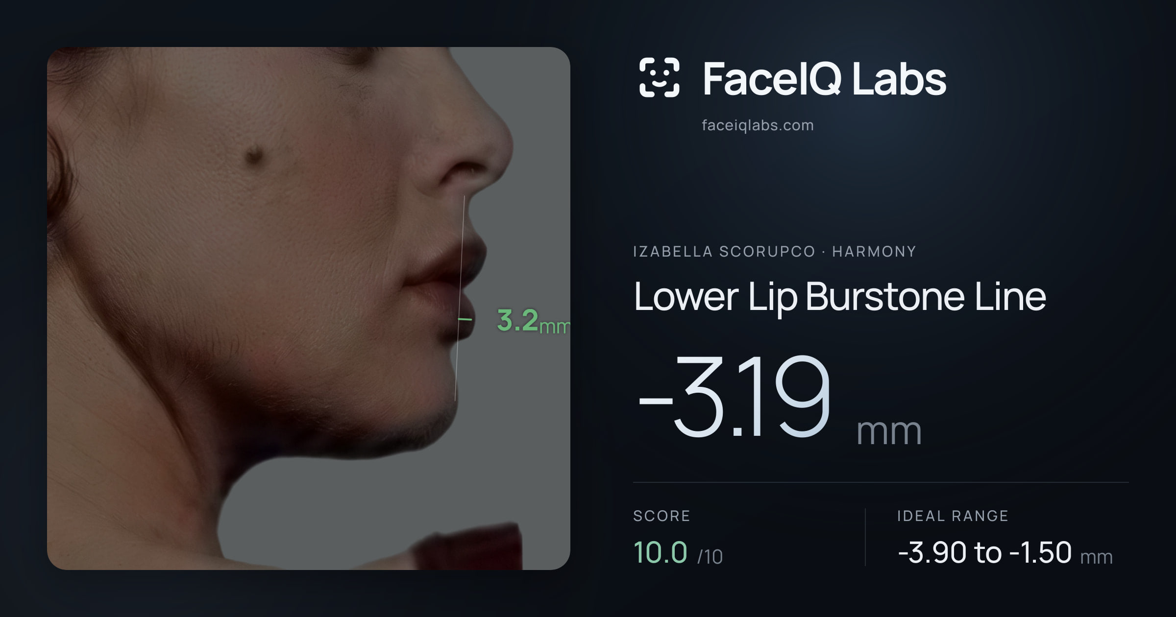 Izabella Scorupco Lower Lip Burstone Line: -3.19mm, drawn on the photo