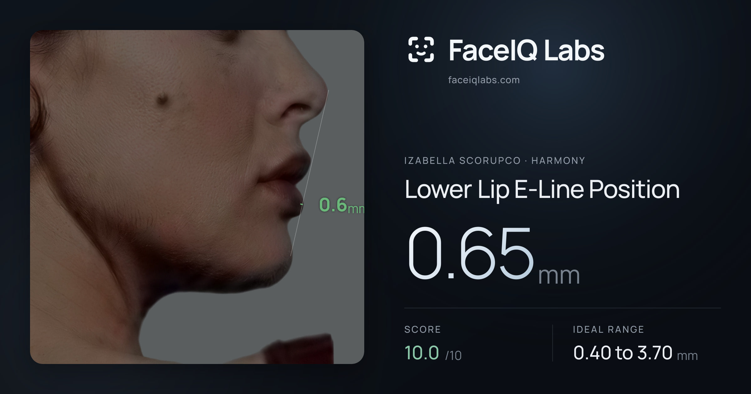 Izabella Scorupco Lower Lip E-Line Position: 0.65mm, drawn on the photo