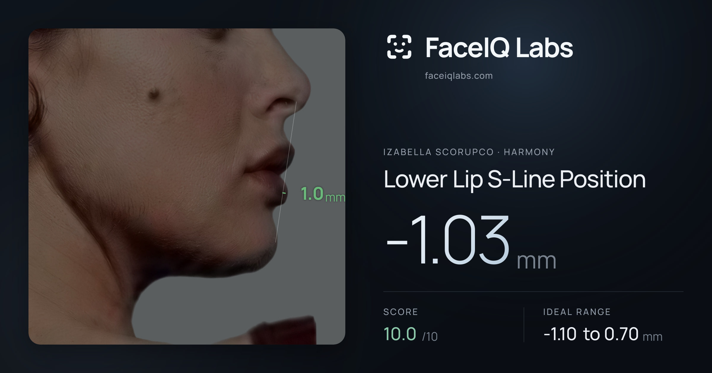 Izabella Scorupco Lower Lip S-Line Position: -1.03mm, drawn on the photo