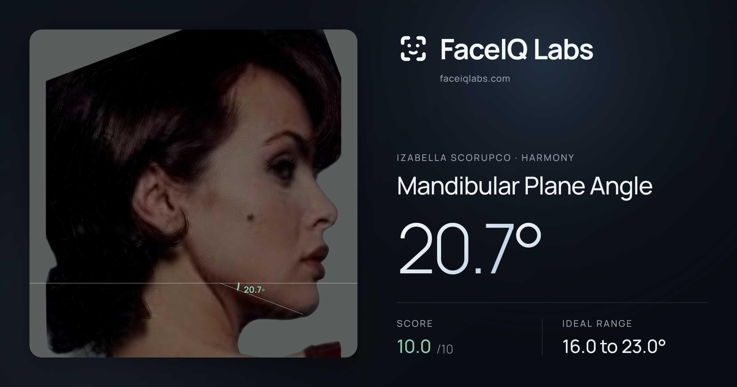 Izabella Scorupco Mandibular Plane Angle: 20.7°, drawn on the photo