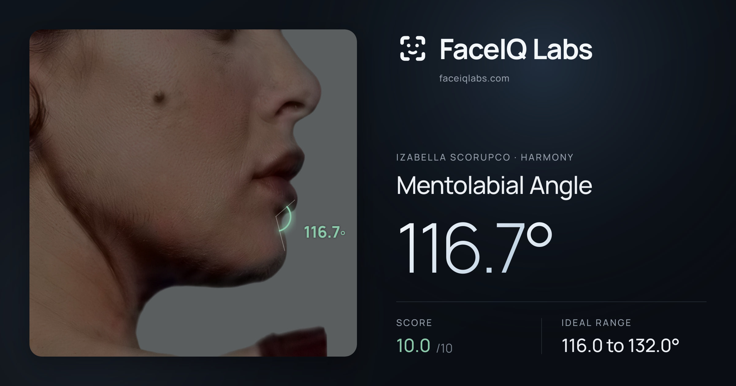 Izabella Scorupco Mentolabial Angle: 116.7°, drawn on the photo