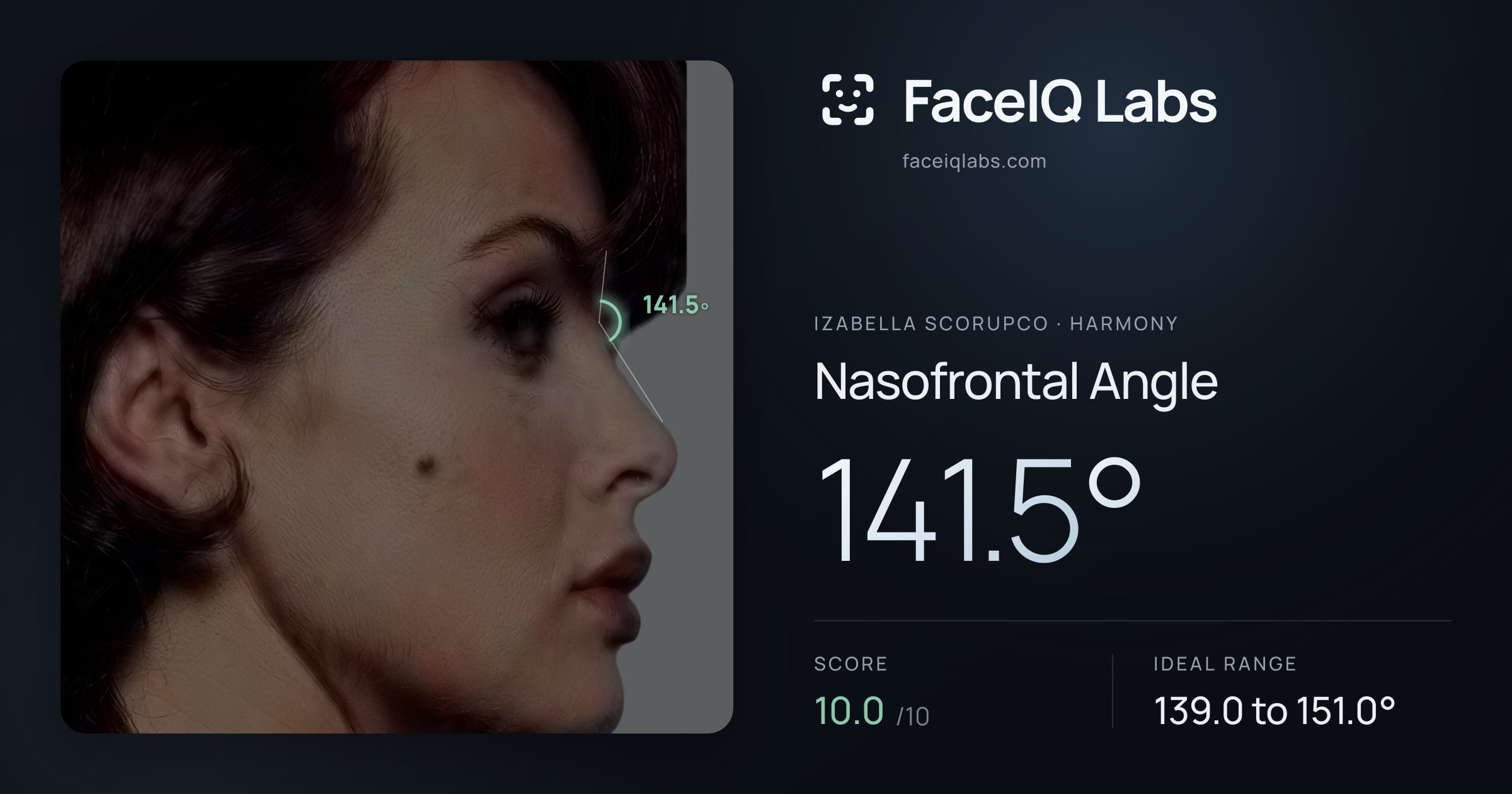 Izabella Scorupco Nasofrontal Angle: 141.5°, drawn on the photo