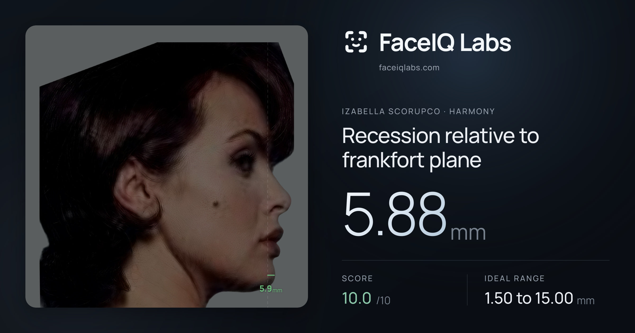 Izabella Scorupco Recession relative to frankfort plane: 5.88mm, drawn on the photo