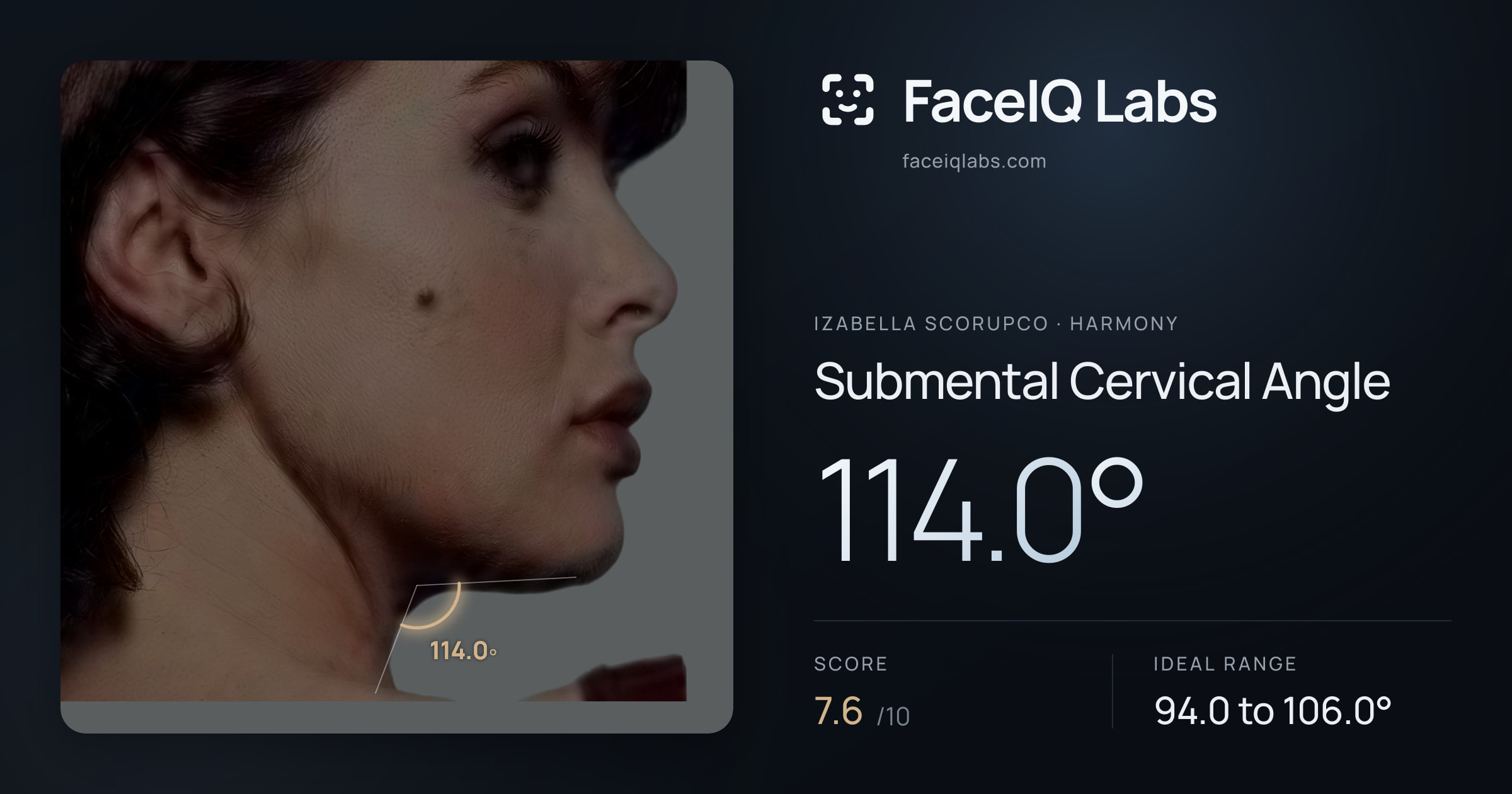 Izabella Scorupco Submental Cervical Angle: 114.0°, drawn on the photo