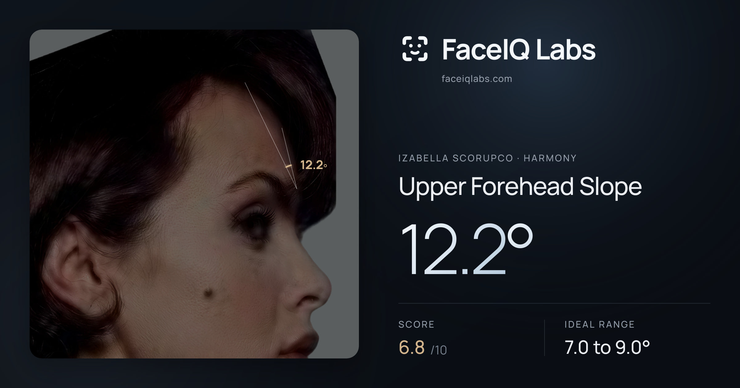 Izabella Scorupco Upper Forehead Slope: 12.2°, drawn on the photo