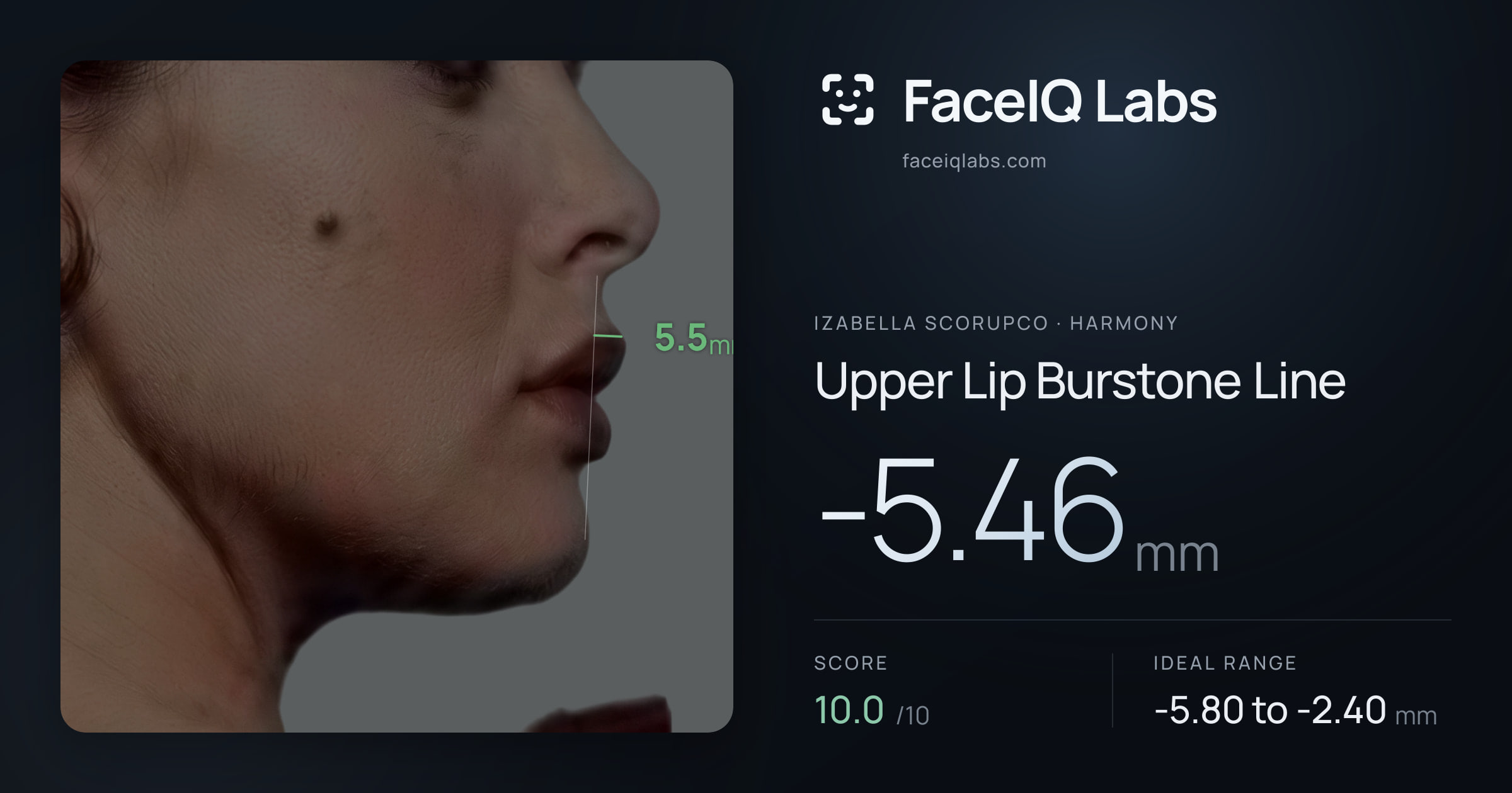 Izabella Scorupco Upper Lip Burstone Line: -5.46mm, drawn on the photo