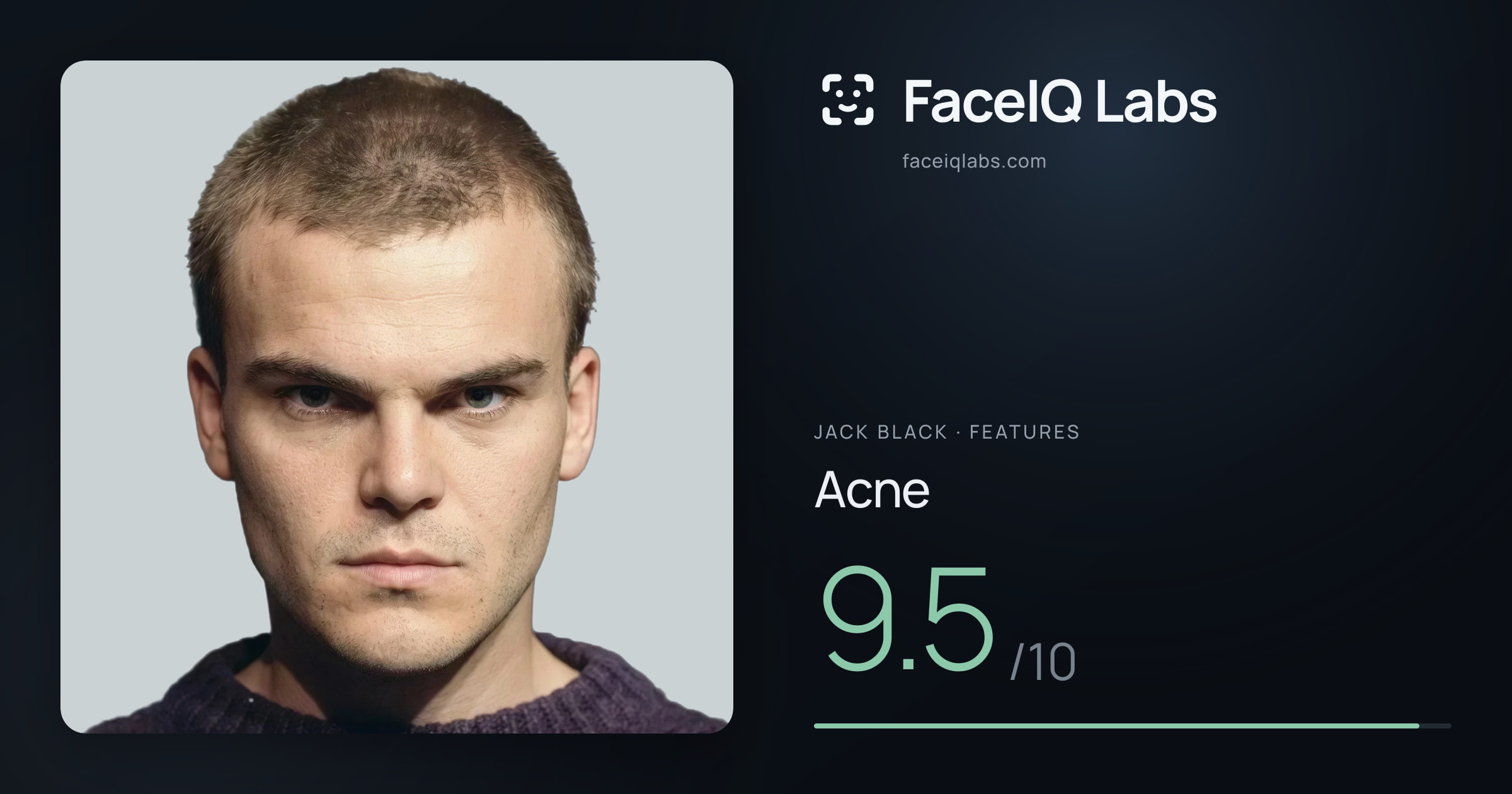 Jack Black Acne: 9.5/10, drawn on the photo